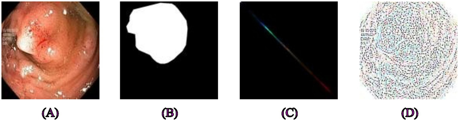 (A) Endoscopic view of internal tissue with visible inflammation spots. (B) Black and white silhouette derived from the endoscopic image. (C) Spectrum line displaying various colors on a black background. (D) Circular diagram composed of densely packed multicolored dots.