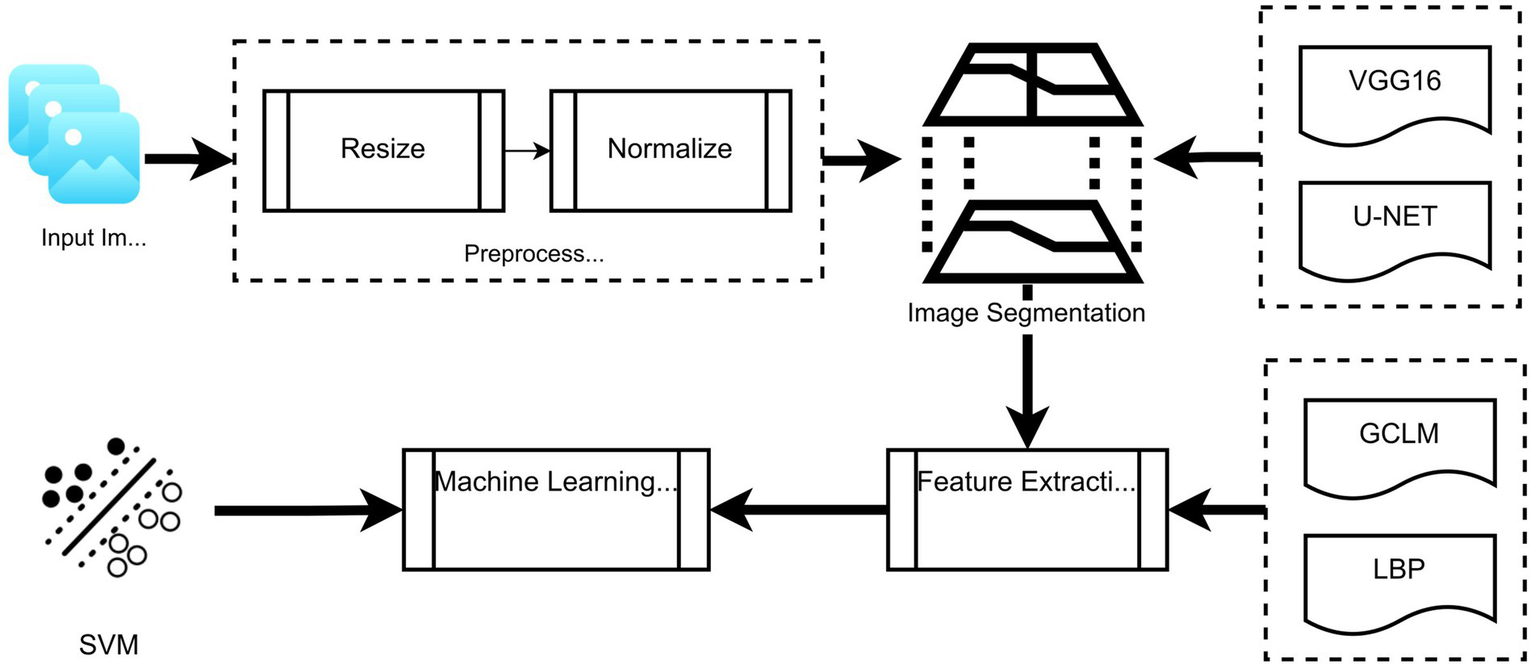 Flowchart depicting an image processing pipeline. Input images undergo preprocessing involving resizing and normalization. Image segmentation is performed using VGG16 or U-NET models. Features are extracted via GCLM or LBP methods before machine learning, culminating in SVM classification. Arrows indicate progression through the workflow.