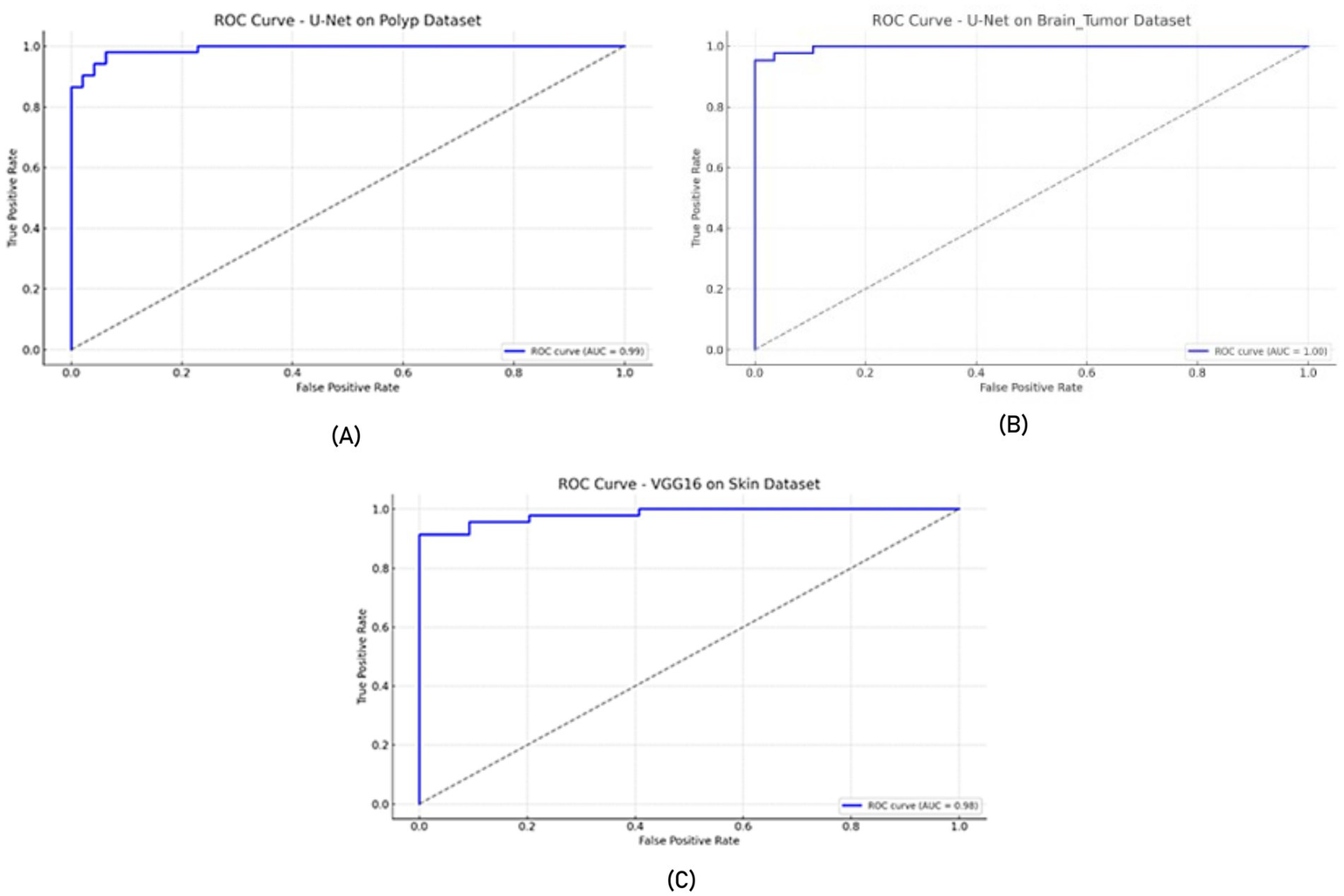 Three ROC curve graphs are displayed. (A) U-Net on the Polyp dataset with an AUC of 0.99. (B) U-Net on the Brain Tumor dataset with an AUC of 1.00. (C) VGG16 on the Skin dataset with an AUC of 0.98. Each graph plots True Positive Rate against False Positive Rate.