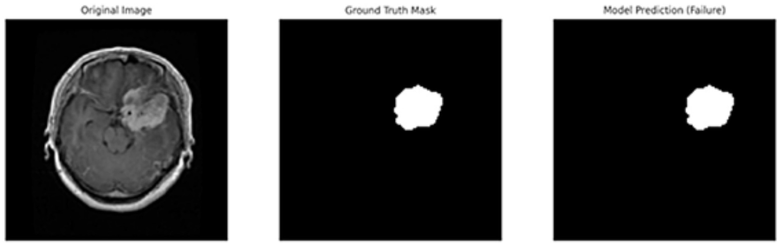 MRI scan comparison in three panels. The left panel shows the original brain image. The middle panel displays the ground truth mask highlighting a specific region. The right panel shows the model prediction mask, similar to the ground truth but labeled as a failure.