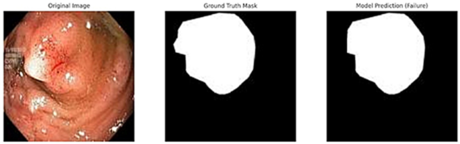 Three-panel image comparing polyp identification. The left panel shows the original endoscopic image of a polyp. The middle panel is a ground truth mask indicating the polyp's location. The right panel displays a model's prediction, which inaccurately highlights a slightly larger area.