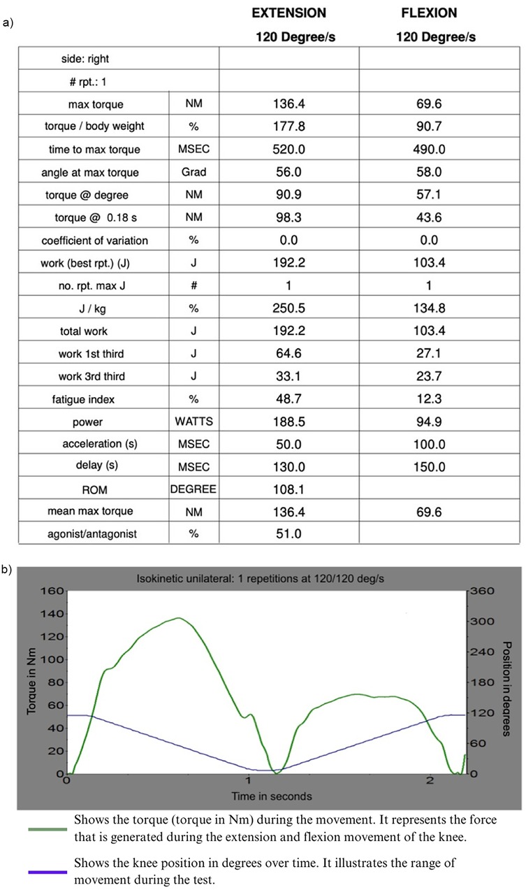 Table comparing knee extension and flexion metrics at 120 degrees per second. Key figures include max torque, torque relative to body weight, and time to max torque for both extension and flexion. A line graph shows torque in newton meters and knee position in degrees over time for one isokinetic unilateral repetition. Green and purple lines indicate torque and knee position, respectively, illustrating changes during movement.