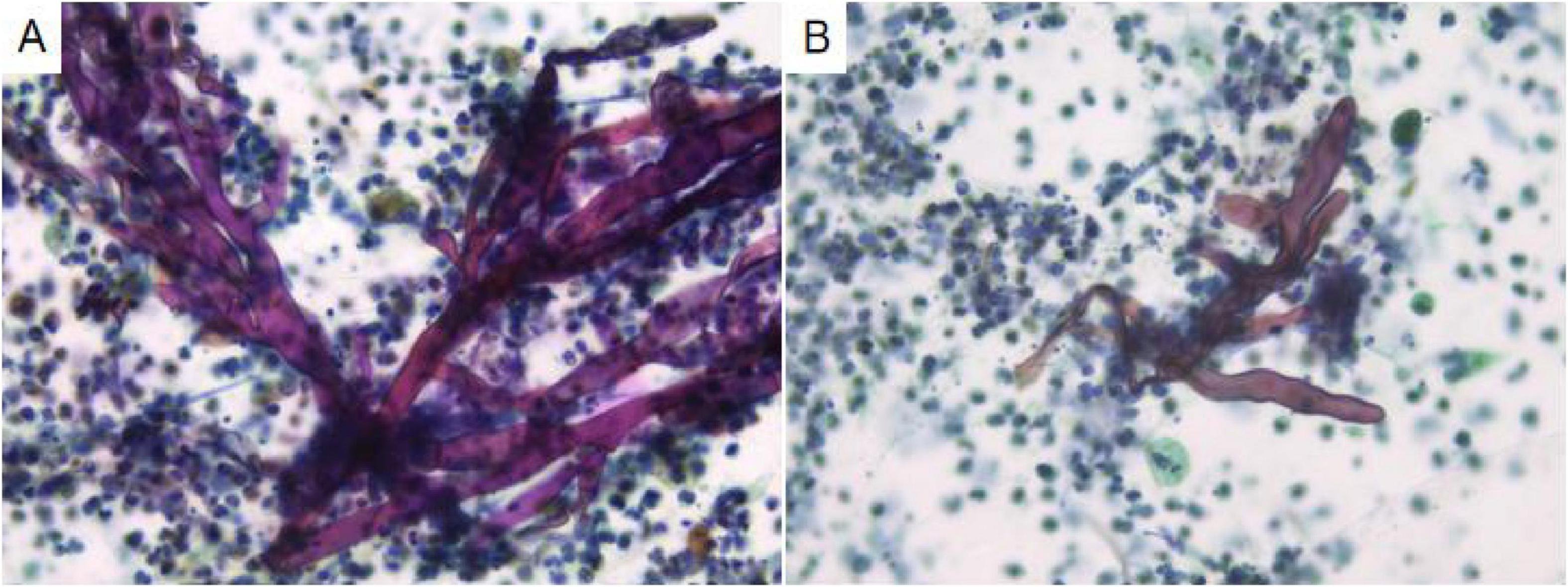 Microscopic images labeled A and B show fungal structures with branching hyphae. Image A displays densely packed, reddish-purple hyphae. Image B shows sparser structures with similar coloration, surrounded by numerous smaller blue and green stained cells.