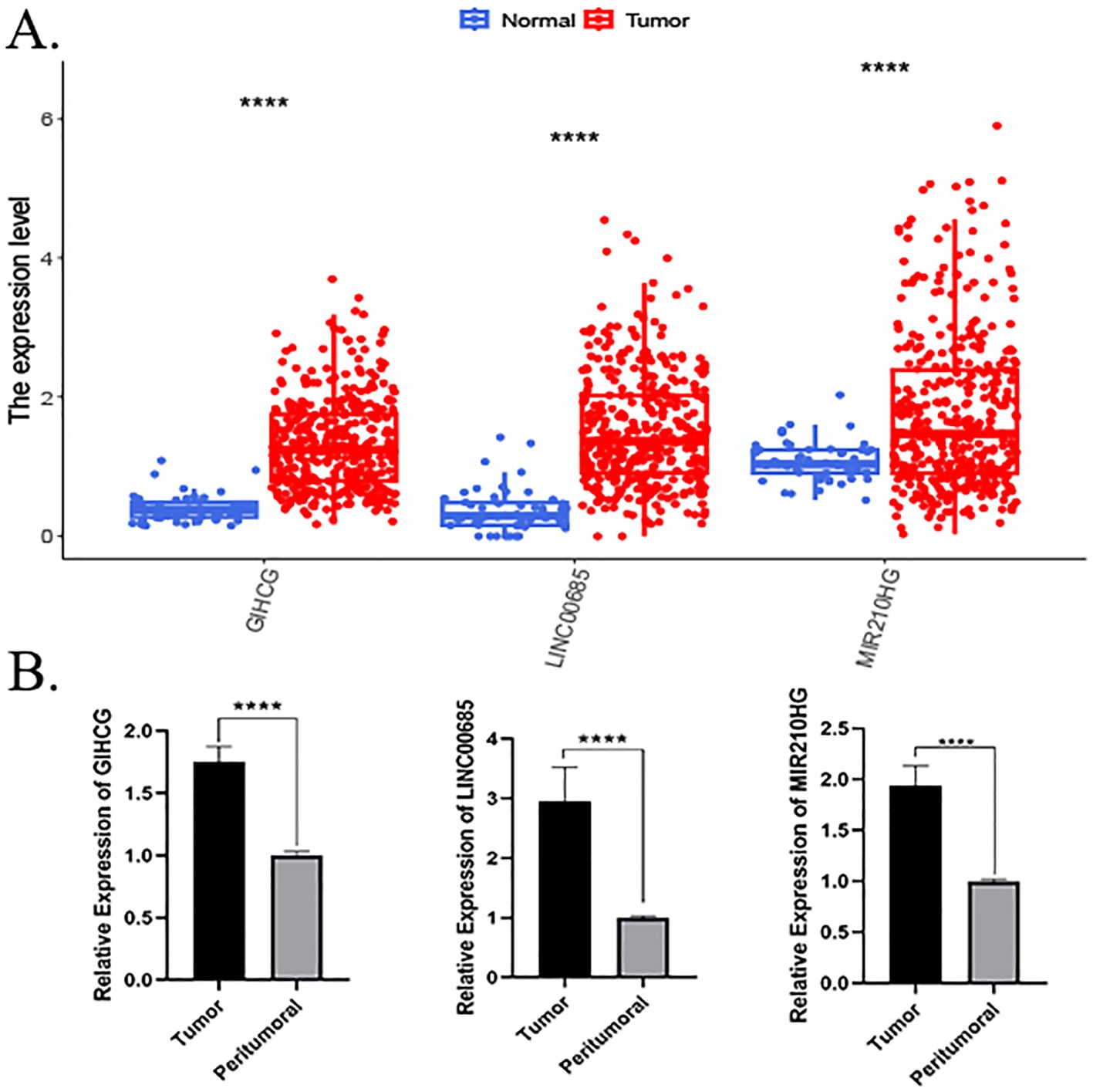 Graph A shows expression levels of GIHCG, LINC00685, and MIR210HG in normal (blue) and tumor (red) samples, with tumor levels significantly higher. Graph B displays bar charts of the same genes comparing expression in tumor and peritumoral tissues, indicating higher expression in tumor tissues.