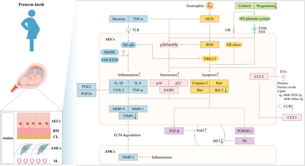 Flowchart illustrating the molecular and cellular pathways involved in preterm birth. It shows interactions between bacteria, immune responses, signaling molecules, inflammation, senescence, and apoptosis. Key elements include cytokines, MAPK, JAK/STAT, ROS, and NETs. The diagram highlights the roles of inflammation, ECM degradation, and senescence in preterm birth. Various pathways like cortisol, progesterone, and the uPA/plasmin system are also depicted, alongside cellular components such as neutrophils and AECs. The image illustrates the complex network of interactions contributing to preterm birth.