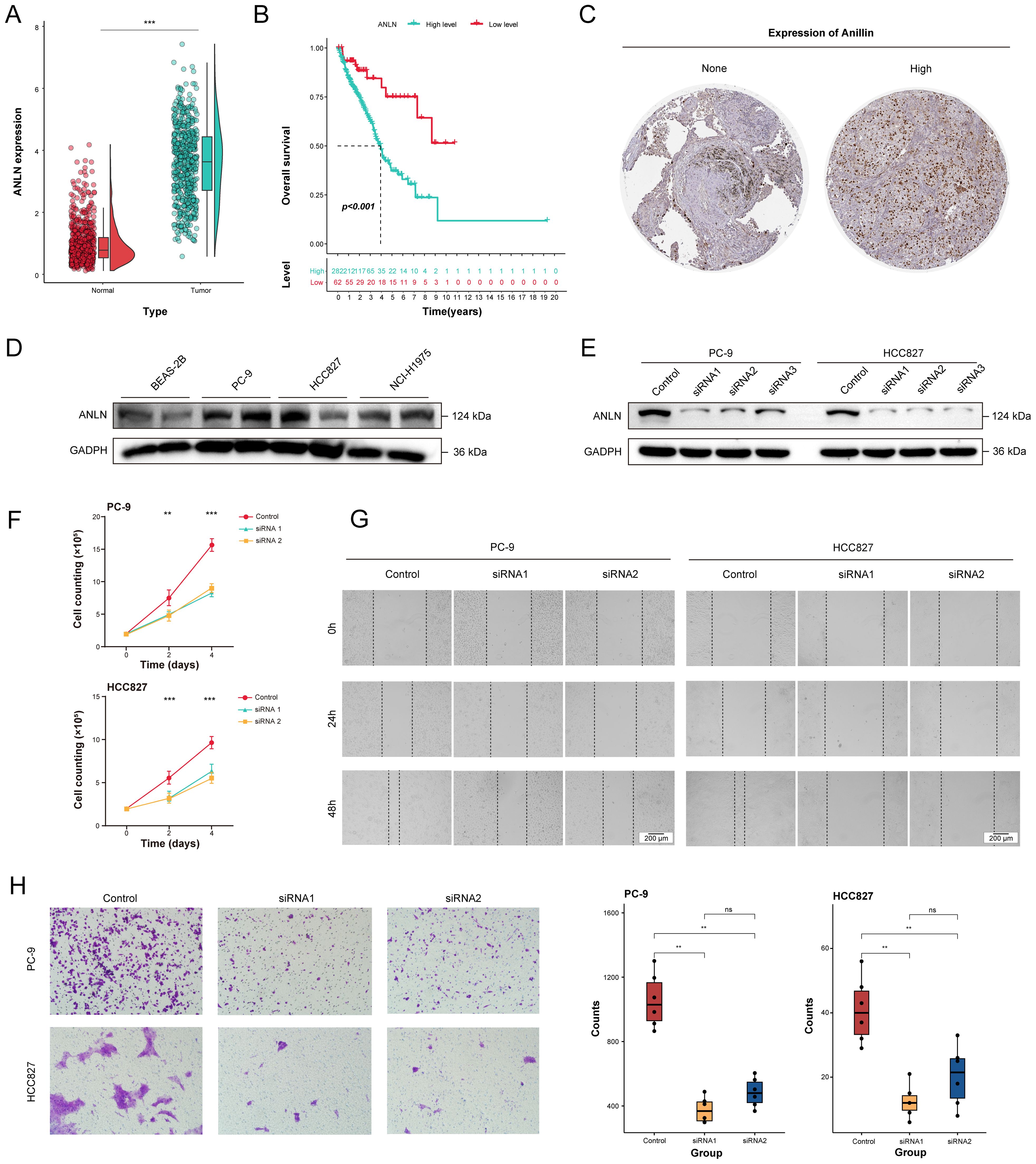 A series of figures related to ANLN expression and its effects. (A) Violin plot comparing ANLN expression in normal and tumor tissues. (B) Kaplan-Meier survival curve showing overall survival stratified by ANLN expression levels. (C) Histological images indicating low and high ANLN expression. (D) Western blot of ANLN in different cell lines. (E) ANLN knockdown via siRNA in PC-9 and HCC827 cells shown by Western blot. (F) Growth curves for PC-9 and HCC827 cells with control and siRNA treatment. (G) Wound healing assay for PC-9 and HCC827 cells. (H) Transwell migration assay images and boxplots for PC-9 and HCC827 cell groups.