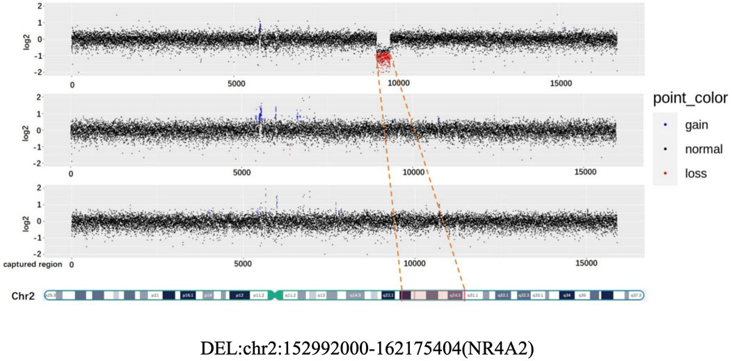 Scatter plot showing three graphs of genomic data with log2 values on the y-axis and captured regions on the x-axis. Each plot is filled with black points mostly concentrated around zero, indicating normal states, with some blue points showing gains and red points highlighting deletions. An orange dashed line highlights a deletion in log2 values of chromosome 2, labeled DEL:chr2:152992000-162175404(NR4A2), corresponding to a deletion in the chromosomal band. A chromosome 2 ideogram appears below, showing specific regions like p21 and q21.