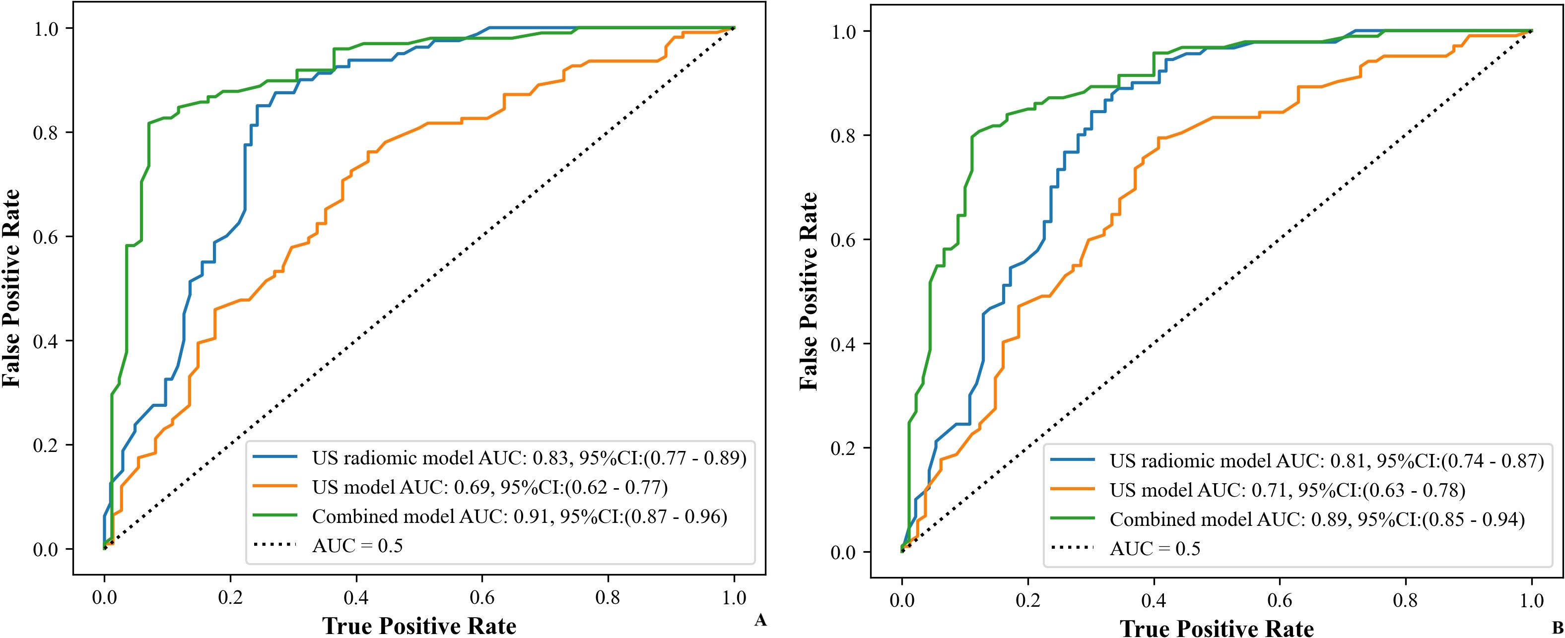 Two ROC curve plots compare diagnostic models. The left plot shows the US radiomic model (AUC: 0.83), US model (AUC: 0.69), and combined model (AUC: 0.91). The right plot displays the US radiomic model (AUC: 0.81), US model (AUC: 0.71), and combined model (AUC: 0.89). The combined models perform best in both plots.