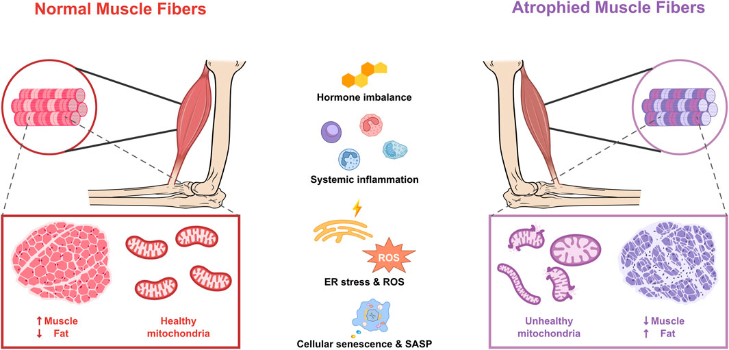 Comparison between normal and atrophied muscle fibers. Normal fibers on the left show increased muscle, decreased fat, and healthy mitochondria. Atrophied fibers on the right show decreased muscle, increased fat, and unhealthy mitochondria. Factors include hormone imbalance, systemic inflammation, ER stress, ROS, and cellular senescence.