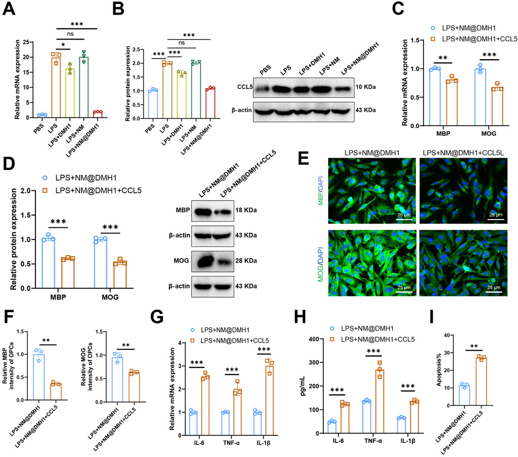 Graphs and immunofluorescence images depict cellular and molecular analyses. Panels A, B, and C show graphs of relative mRNA and protein expression with significance markers. Panel E displays immunofluorescence images of cells stained for MBP and MOG in green with DAPI in blue. Panels D, F, G, H, and I present bar graphs demonstrating protein expression, intensity, cytokine levels, and apoptosis comparisons between treatments, indicated by significance stars.