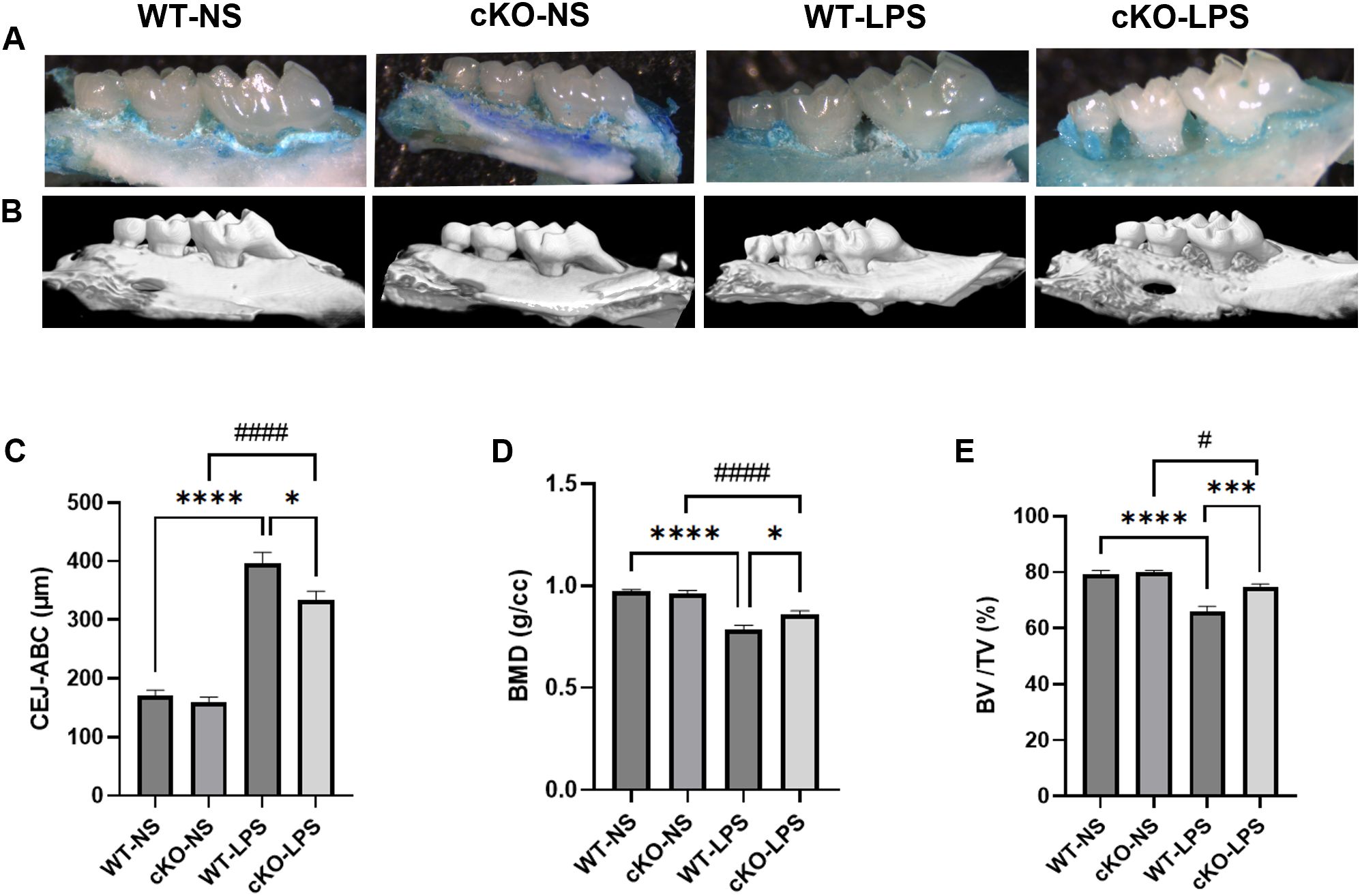 Dental images and graphs showing the effects of different treatments. Panel A displays four images of maxillae staining by methylene blue, labeled WT-NS, cKO-NS, WT-LPS, and cKO-LPS. Panel B shows corresponding 3D reconstruction images of the maxillae. Panels C, D, and E present bar graphs comparing CEJ-ABC distance, BMD, and BV/TV percentage across the groups, with statistical significance indicated by asterisks and hashes.