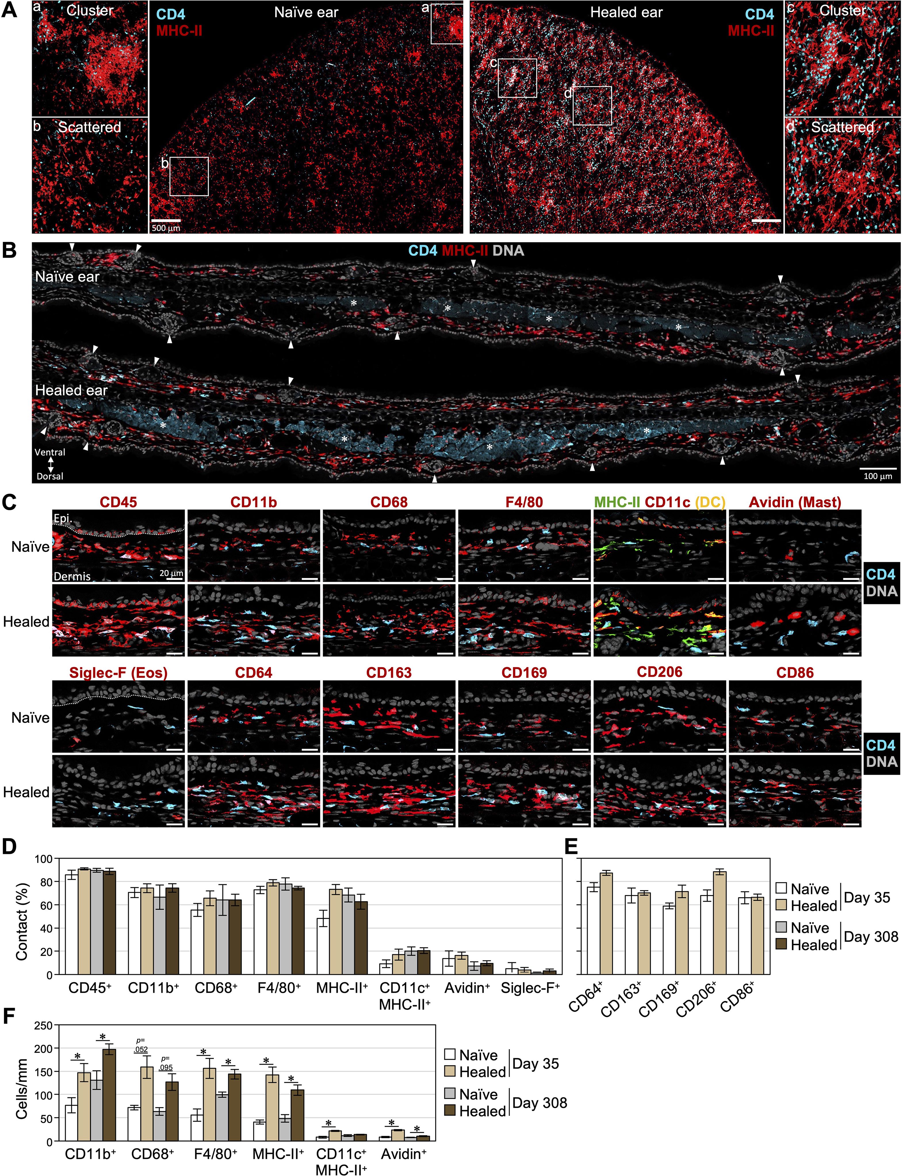Fluorescence microscopy panels and bar graphs analyzing skin samples from naive and healed mouse ears. Panels A and B show CD4 and MHC-II marker distributions. Panel C displays various cellular markers, including CD45, CD11b, CD68, and others, comparing naive and healed tissues. Panels D-F present bar graphs depicting quantitative analysis of cell contacts (%) and cell density (cells/mm) for different markers over time. Markers and time points are differentiated by colors and shading, highlighting differences between naive and healed conditions.