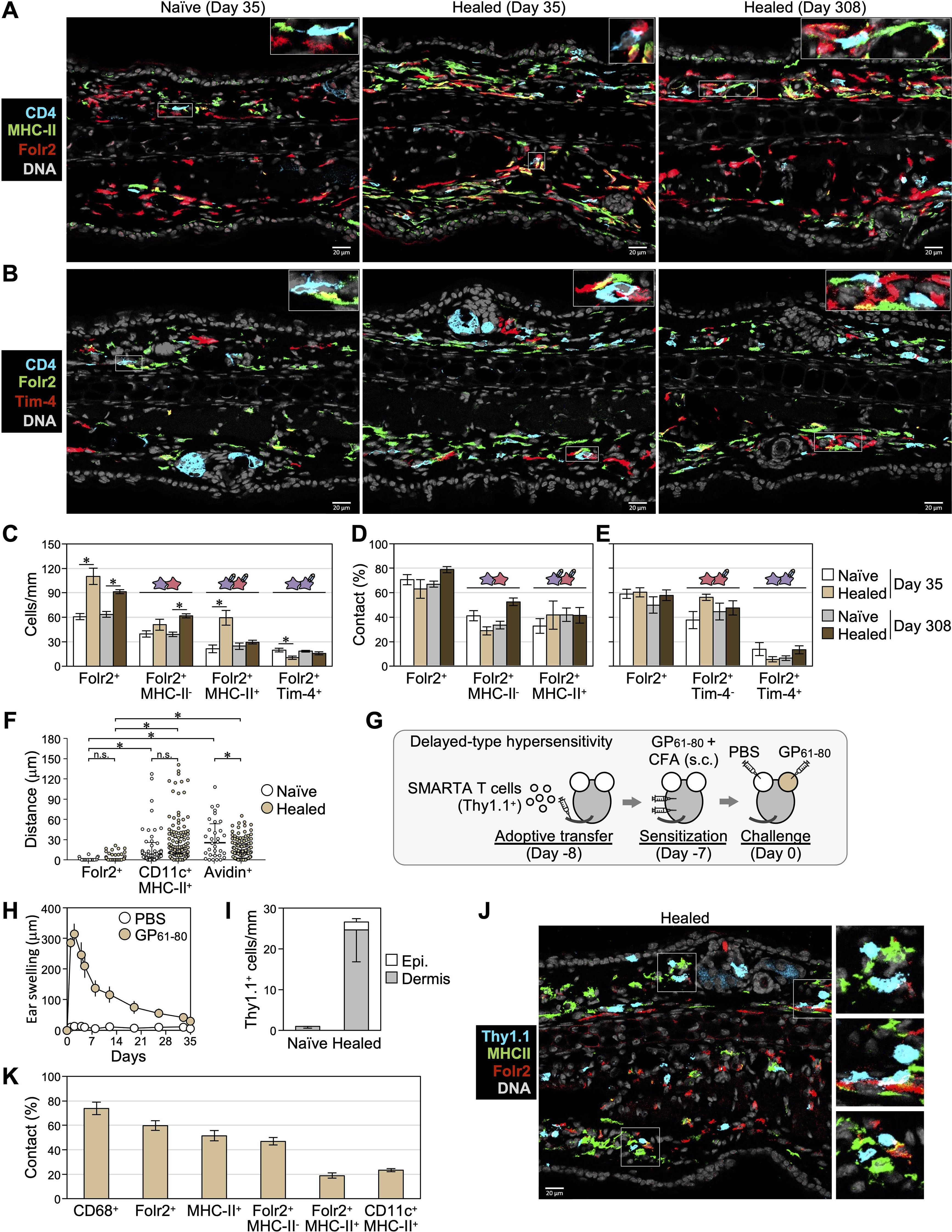 Panels A and B show immunofluorescence images of tissue sections from naive and healed states on days thirty-five and three hundred eight, highlighting CD4, MHC-II, Folr2, Tim-4, and DNA. Panels C to K include graphs and diagrams depicting cell density, distance measurements, and experimental processes. Panel J presents detailed immunofluorescence imagery focusing on Thy1.1, emphasizing cell interactions in a healed state. The images and data collectively illustrate immune responses over time.