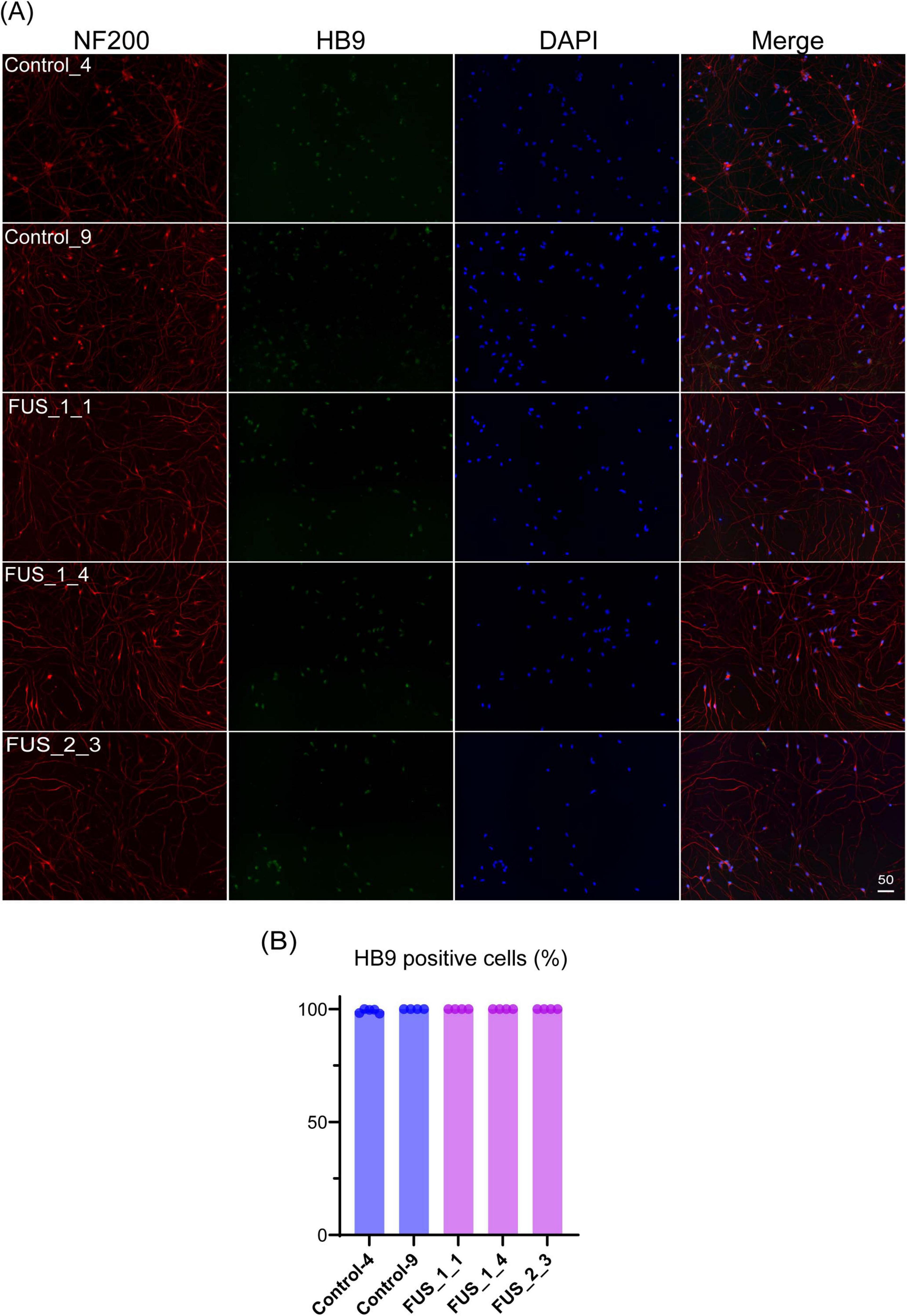 Panel A shows immunofluorescence images of cells stained for NF200 (red), HB9 (green), and DAPI (blue). The merge column combines these stains. Rows are labeled Control_4, Control_9, FUS_1_1, FUS_1_4, and FUS_2_3. Panel B is a bar chart depicting the percentage of HB9 positive cells, with control and FUS transfections indicated. Bars are color-coded, with controls in blue and FUS transfections in pink.