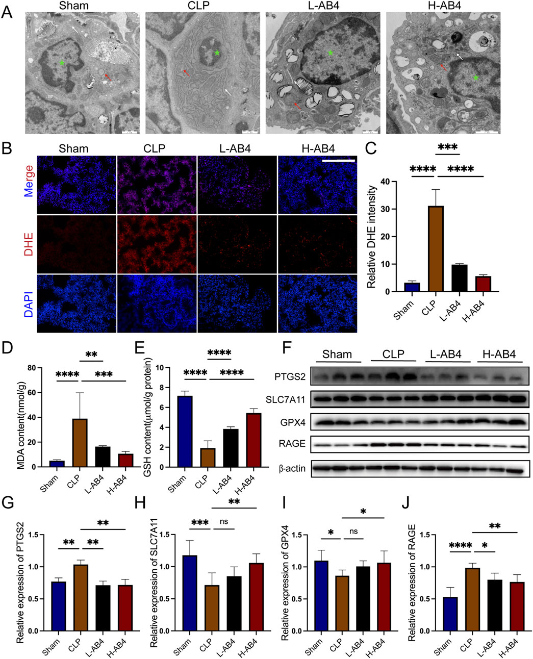 Panel A shows electron microscopy images of cells under four conditions: Sham, CLP, L-AB4, and H-AB4, highlighting ultrastructural changes with green and red markers. Panel B displays fluorescence microscopy images with sections for DHE and DAPI staining under the same conditions, showing varying intensities. Panel C is a bar graph comparing relative DHE intensity across conditions, showing a significant increase in the CLP group. Panels D and E are bar graphs showing MDA and GSH content, respectively, with significant differences noted. Panel F includes a Western blot analysis for PTGS2, SLC7A11, GPX4, and RAGE expression. Panels G-J display bar graphs quantifying the expression of PTGS2, SLC7A11, GPX4, and RAGE, showing significant differences across conditions.