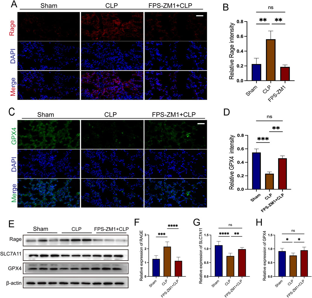Fluorescence microscopy images and bar graphs depict the expression of Rage, GPX4, and other proteins in Sham, CLP, and FPS-ZM1+CLP groups. Panels A and C show DAPI-stained nuclei (blue) and specific protein markers (red and green, respectively), with merged images below. Bar graphs B and D illustrate relative intensity levels, indicating significant differences denoted by asterisks. Panel E shows western blot bands for Rage, SLC7A11, GPX4, and β-actin, with corresponding bar graphs F, G, and H presenting the relative expression levels. Statistical significance is indicated: ns, non-significant; *, **, ***, **** for increasing significance.