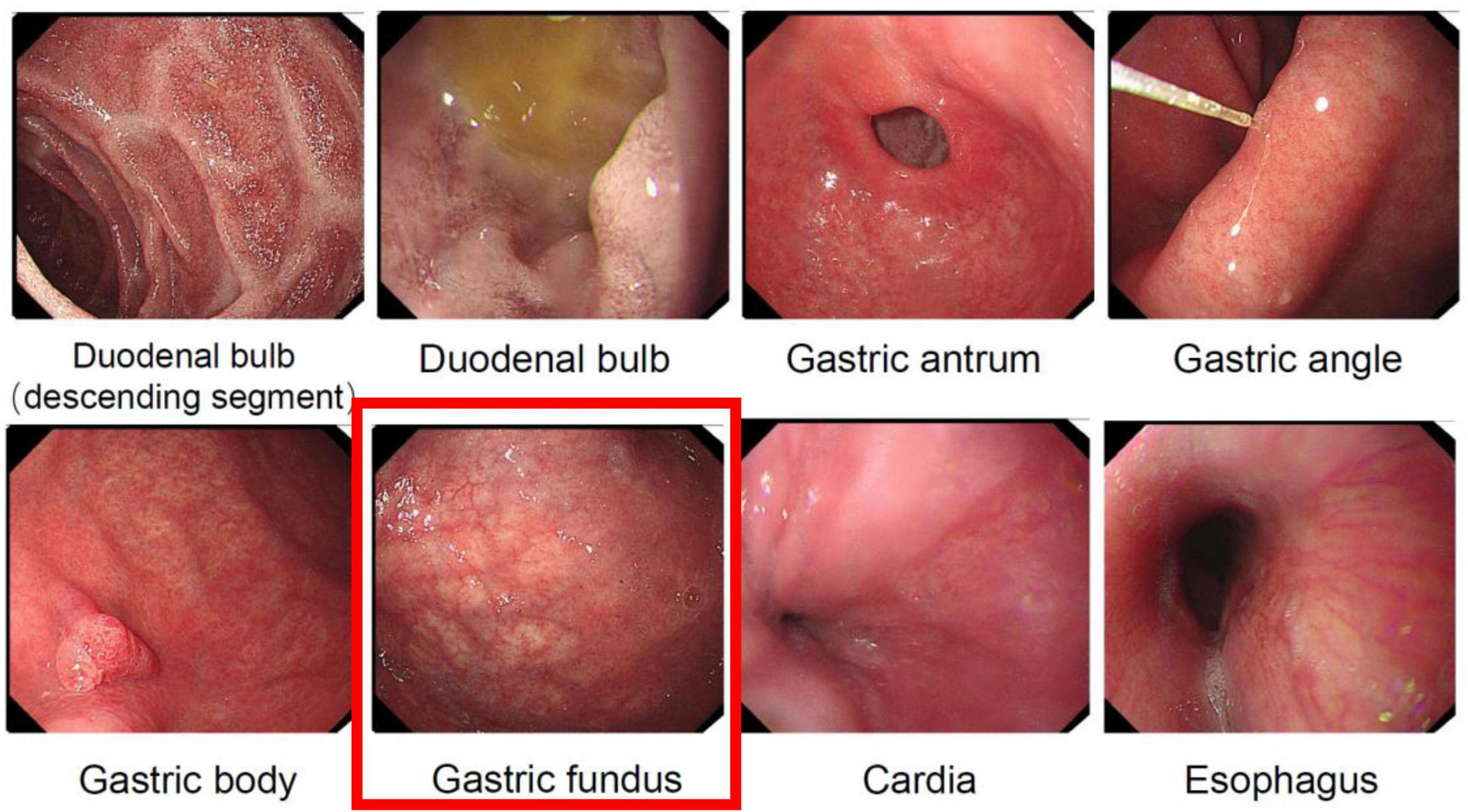 Endoscopic images showing various parts of the digestive tract: duodenal bulb (descending segment and with bile), gastric antrum, gastric angle, gastric body, gastric fundus, cardia, and esophagus, each labeled accordingly.