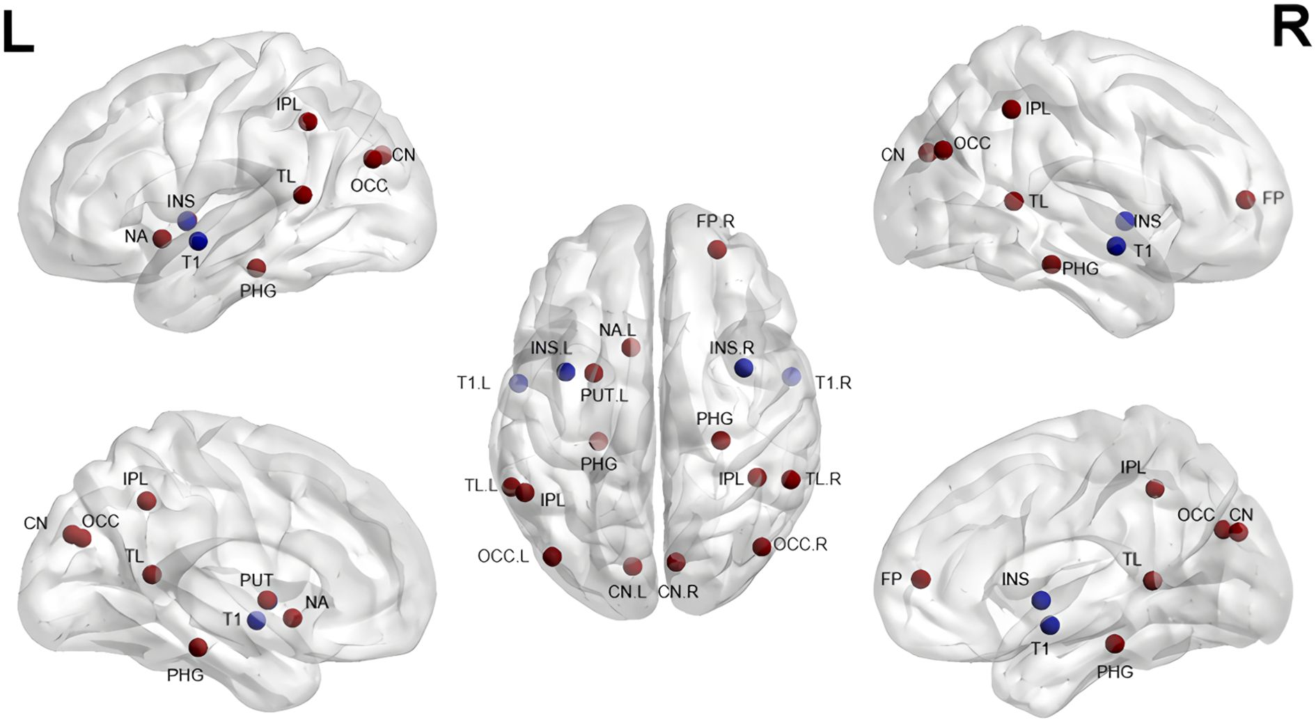 Brain diagrams labeled with regions like IPL, OCC, CN, INS, and PHG, using red and blue dots to indicate specific areas. Different views show left, right, and top perspectives.