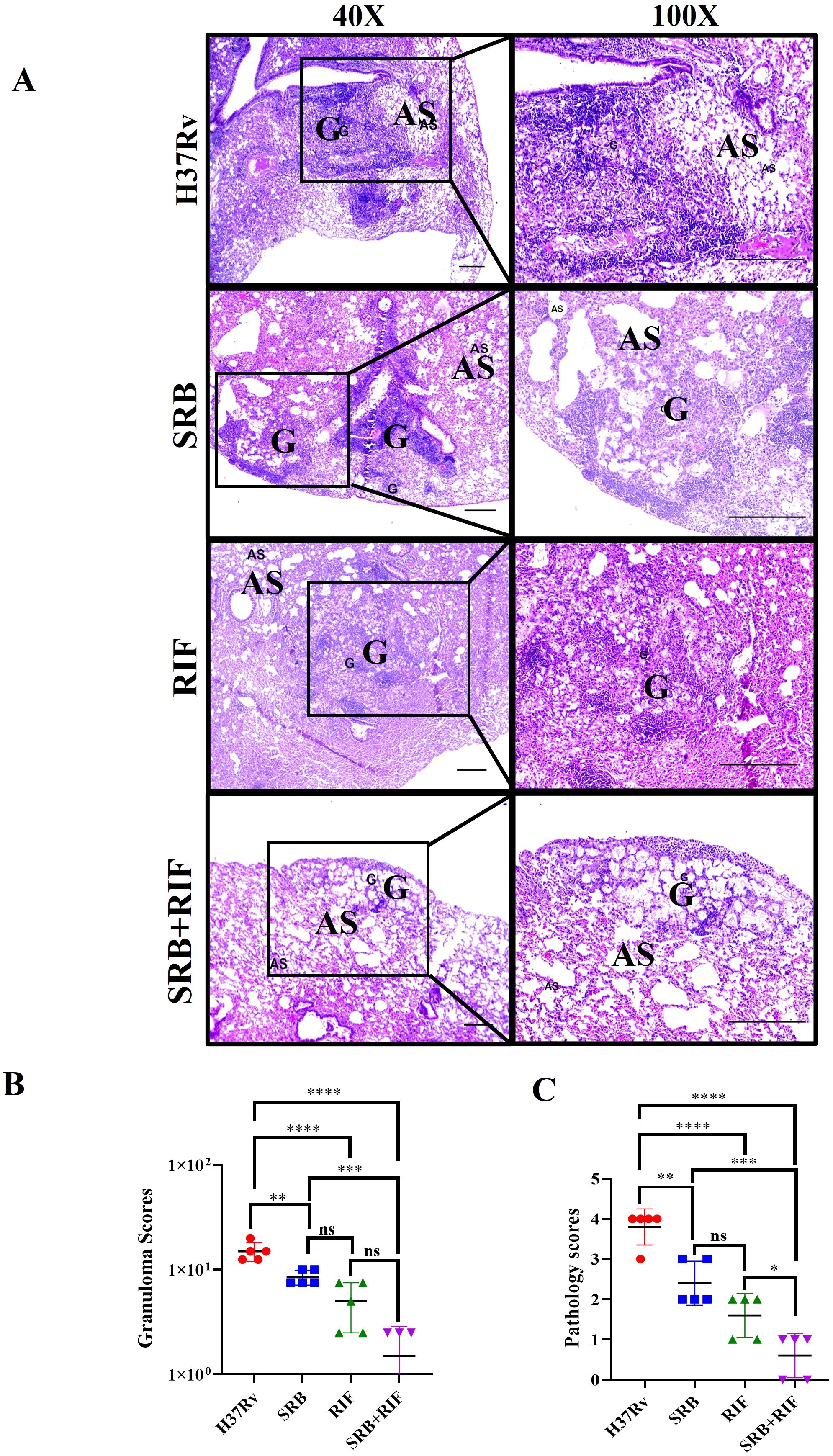 Panel A shows histological sections of lung tissue stained at 40X and 100X magnifications, labeled H37Rv, SRB, RIF, and SRB+RIF. Labels indicate granulomas (G) and alveolar spaces (AS). Panel B is a scatter plot of granuloma scores, and Panel C shows pathology scores, comparing H37Rv, SRB, RIF, and SRB+RIF groups with significance indicators.