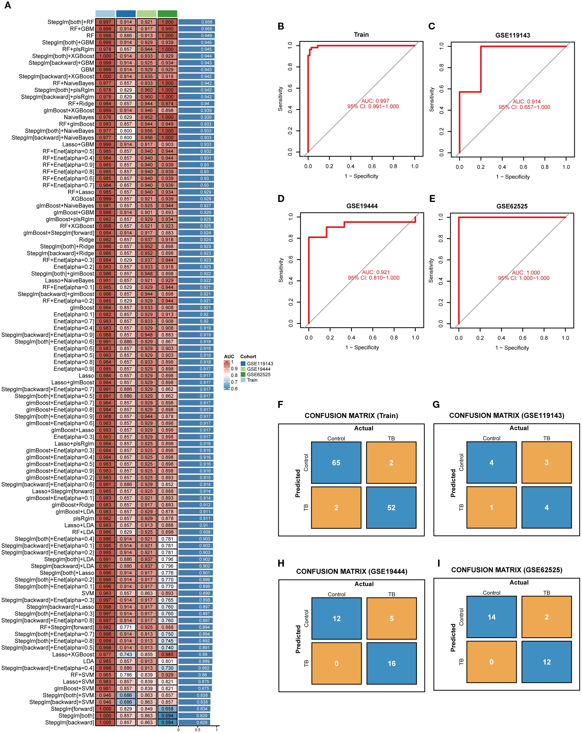 A multi-panel image includes a heatmap, ROC curves, and confusion matrices. Panel A features a heatmap of model performance metrics with a color key for AUC values and cohorts. Panels B-E present ROC curves for different datasets, with specifics on AUC and confidence intervals. Panels F-I display confusion matrices for control and TB predictions across datasets, illustrating the accuracy of classifications.