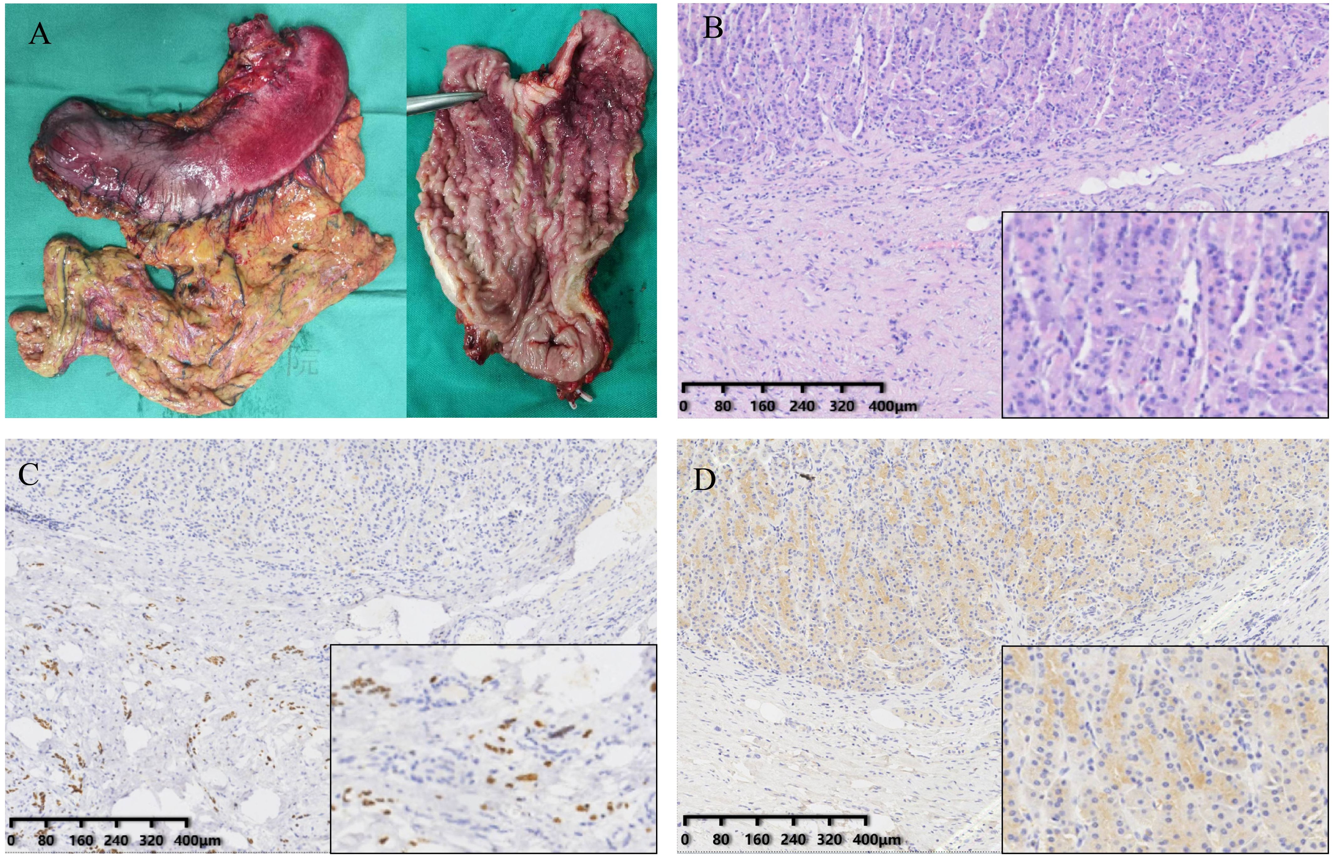 Panel A shows a dissected organ specimen with visible tissue structures. Panels B, C, and D display microscopic images of tissue slides at different magnifications. Each slide includes cell details and an inset highlighting specific cellular features, with scale bars indicating measurements.