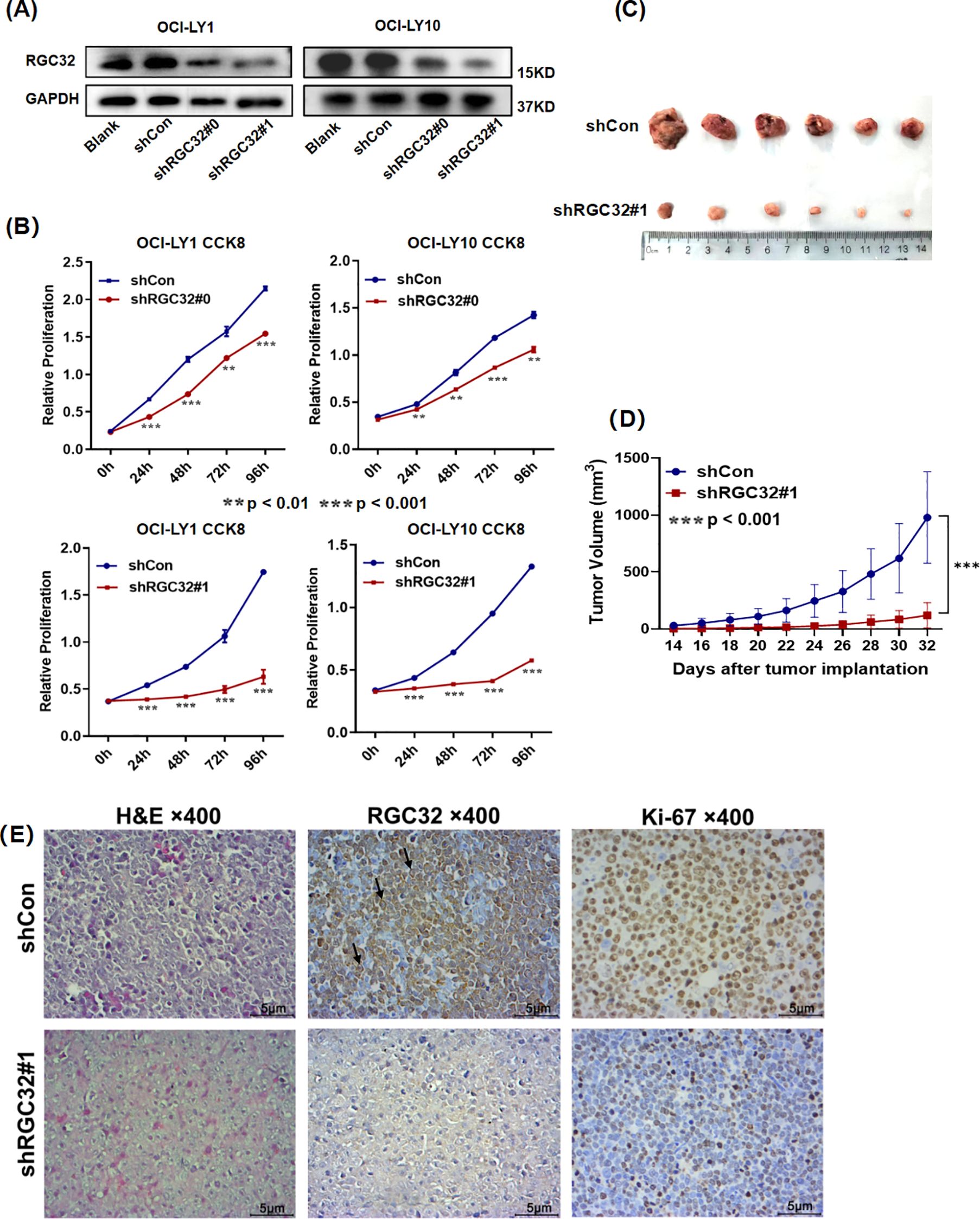 (A) Western blot analysis showing RGC32 and GAPDH expression in OCI-LY1 and OCI-LY10 cells under different conditions. (B) Graphs of relative proliferation over time for OCI-LY1 and OCI-LY10 cells, comparing shCon and shRGC32 conditions. (C) Photo of excised tumors treated with shCon and shRGC32, with a scale. (D) Graph showing tumor volume over time post-implantation under shCon and shRGC32 conditions. (E) Histological images at 400x magnification for H&E, RGC32, and Ki-67 staining, comparing shCon and shRGC32 conditions.