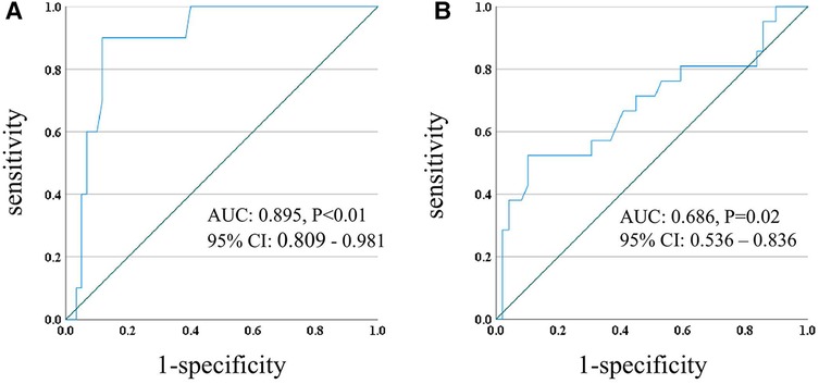 Two ROC curves show diagnostic test performance of PDD in LIS. The left graph shows an AUC of 0.895 with a significant p-value of less than 0.01, and a 95% confidence interval of 0.809 to 0.981. The right graph indicates an AUC of 0.686 with a p-value of 0.02, and a 95% confidence interval of 0.536 to 0.836. Both graphs plot sensitivity against one minus specificity.