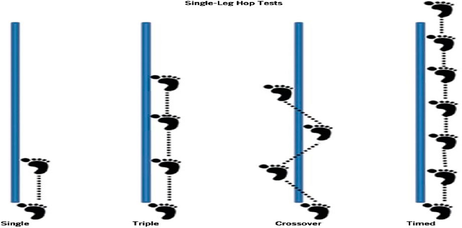 Diagram illustrating four types of single-leg hop tests along blue lines. From left to right: Single hop with one footprint, Triple hop with three footprints, Crossover hop with footprints crossing the line, Timed hop with repeated footprints along the line.