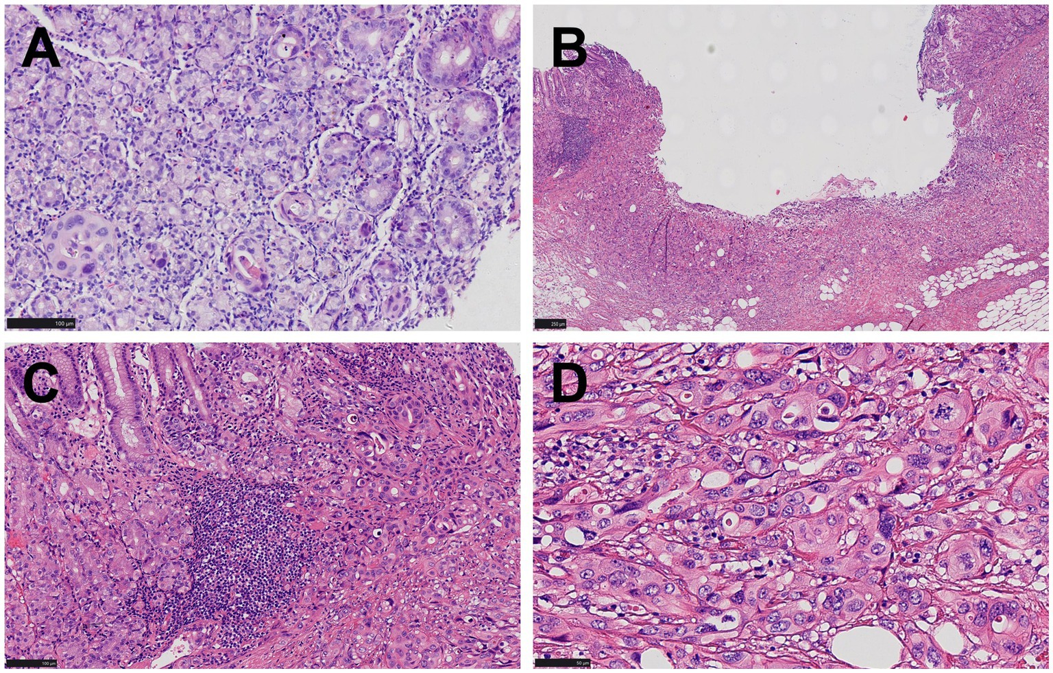 Microscopic images labeled A, B, C, and D show histological sections. Image A displays dense cellular structures, likely glands. Image B shows a section with a clear boundary and less dense tissue. Image C depicts dense cellular arrangements with a notable cluster. Image D highlights prominent cellular features, possibly indicating increased cellular activity. Each section varies in cellular density and organization, captured under a microscope with scale bars for measurement.