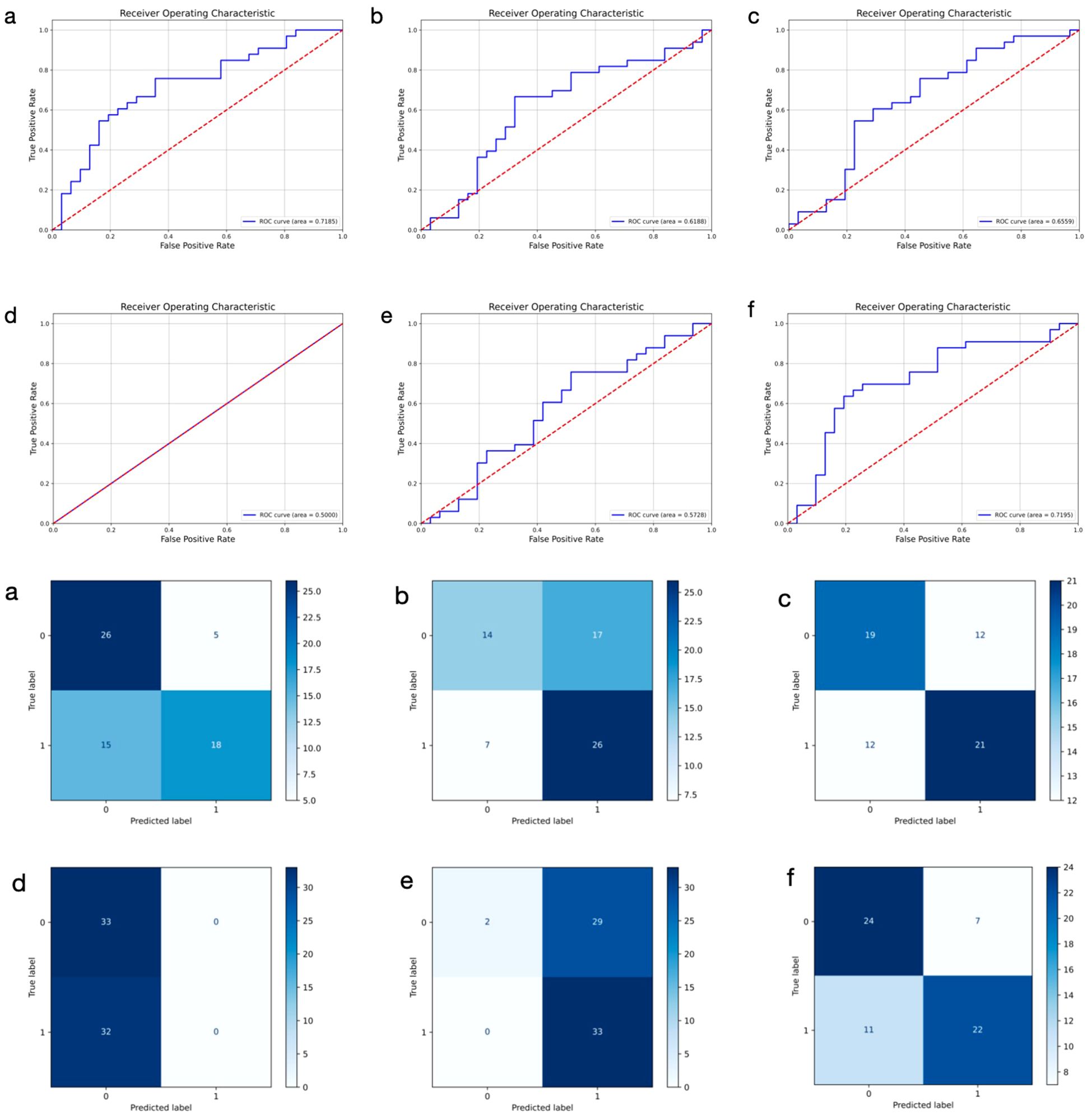 Six panels display Receiver Operating Characteristic (ROC) curves and six panels show confusion matrices. Panels a to f depict ROC curves with varying ROC AUC scores, indicating model performance. Panels a to f at the bottom illustrate confusion matrices with predicted and true label distributions, showing counts of true positives, false positives, true negatives, and false negatives. Each pair of ROC curve and confusion matrix corresponds to a specific model or scenario, providing a comprehensive performance evaluation.