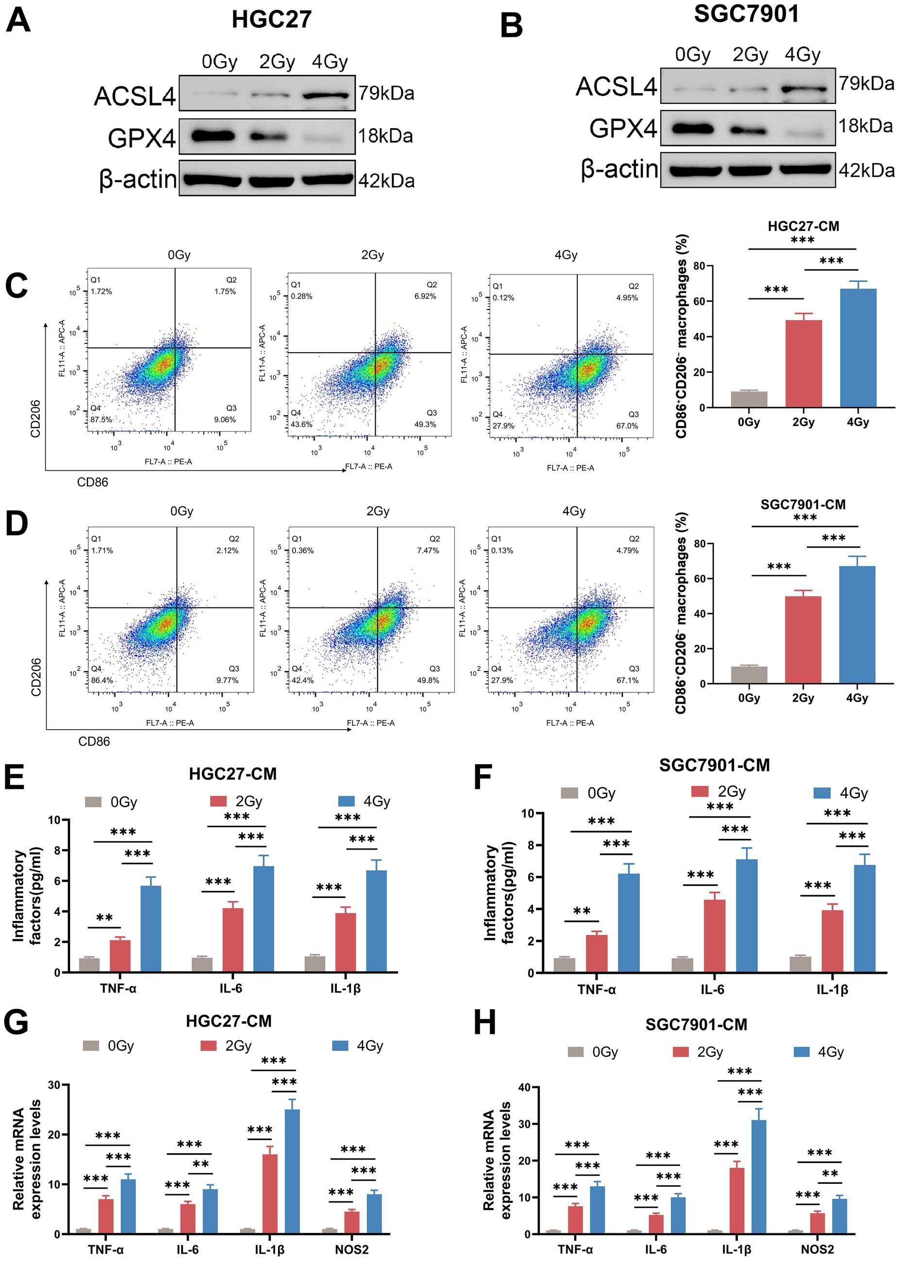 Western blot and flow cytometry figures demonstrate the effects of different radiation doses on HGC27 and SGC7901 cell lines. Panels A and B show protein expression of ACSL4, GPX4, and β-actin at 0 Gray, 2 Gray, and 4 Gray. Panels C and D provide flow cytometry plots illustrating CD86 and CD206 expression. Panels E and F display bar graphs of inflammatory factors TNF-α, IL-6, and IL-1β. Panels G and H show relative mRNA expression levels of TNF-α, IL-6, IL-1β, and NOS2. Statistical significance is indicated with asterisks.