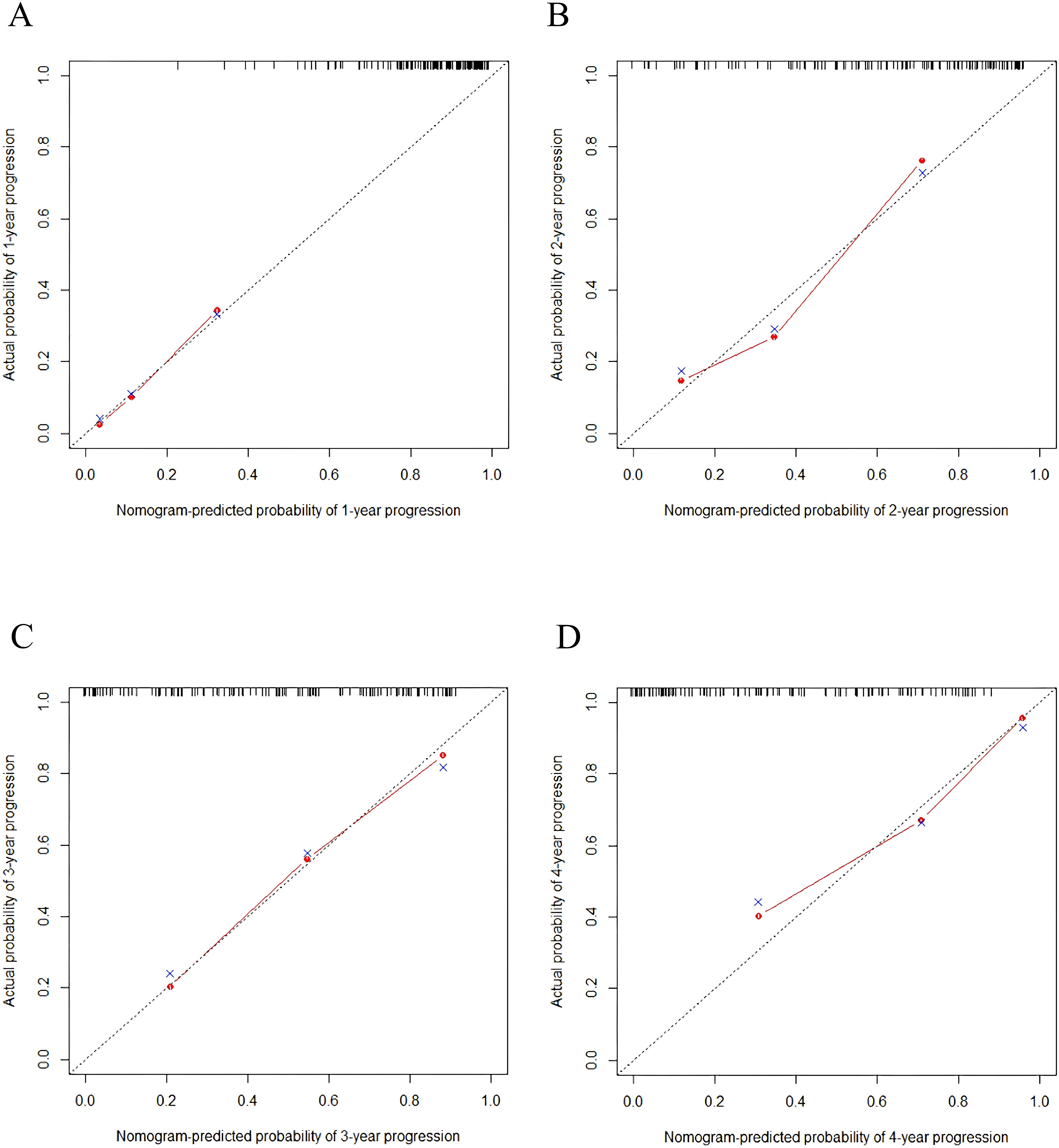 Four calibration plots comparing nomogram-predicted and actual probabilities of cancer progression over one to four years. Graph A shows a close alignment for one year, B shows a slight deviation for two years, C indicates moderate alignment for three years, and D displays some deviation for four years. Each plot features a diagonal line representing perfect prediction, with points and lines illustrating observed data.