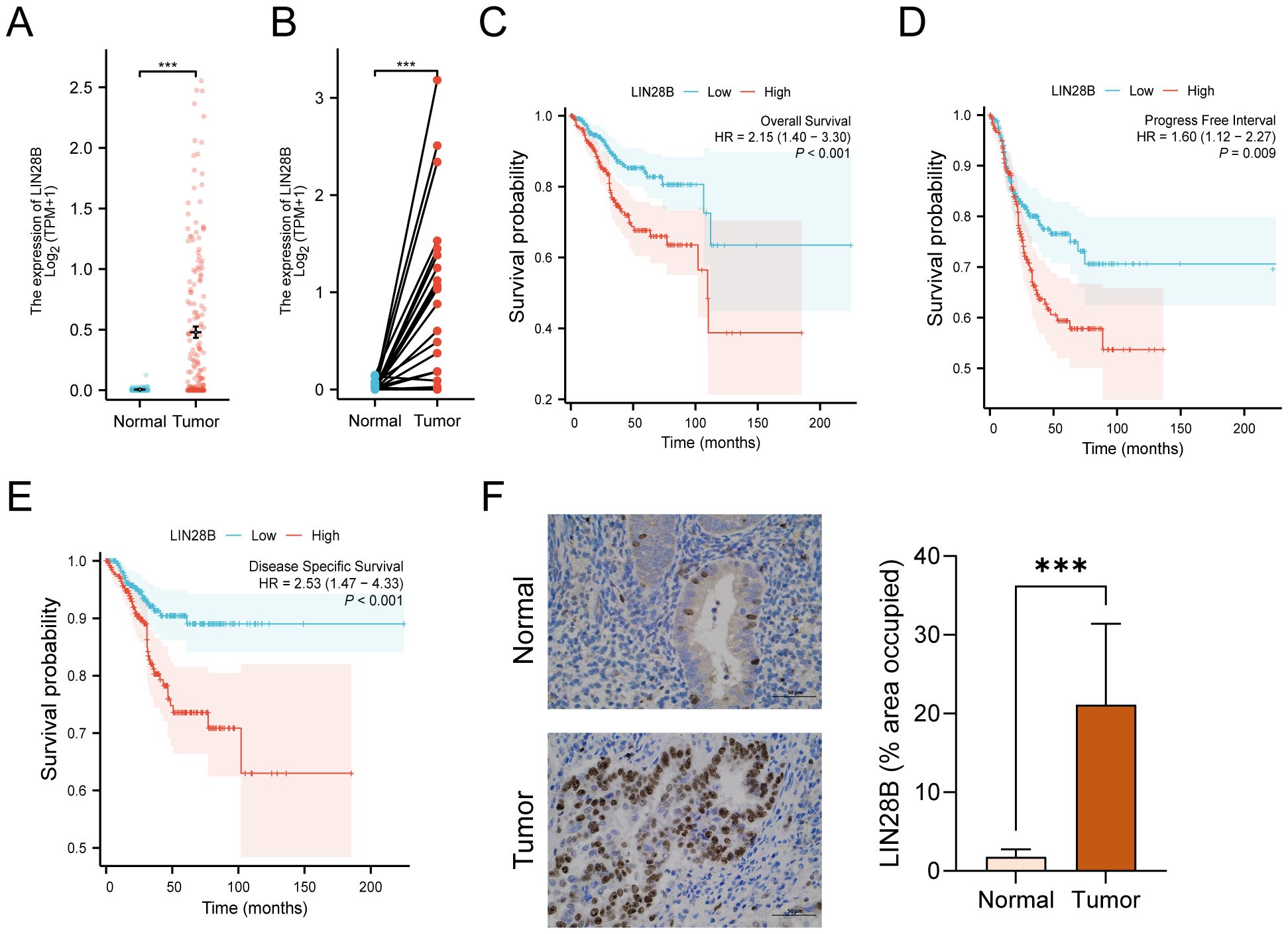 Charts and images on LIN28B expression and survival analysis. Panel A shows higher LIN28B expression in tumors compared to normal tissue. Panel B displays paired expression data confirming the increase in tumors. Panels C, D, and E depict survival probabilities, indicating worse outcomes with higher LIN28B expression. Panel F includes histological images of normal and tumor tissues stained for LIN28B, alongside a bar graph showing increased LIN28B area in tumors.