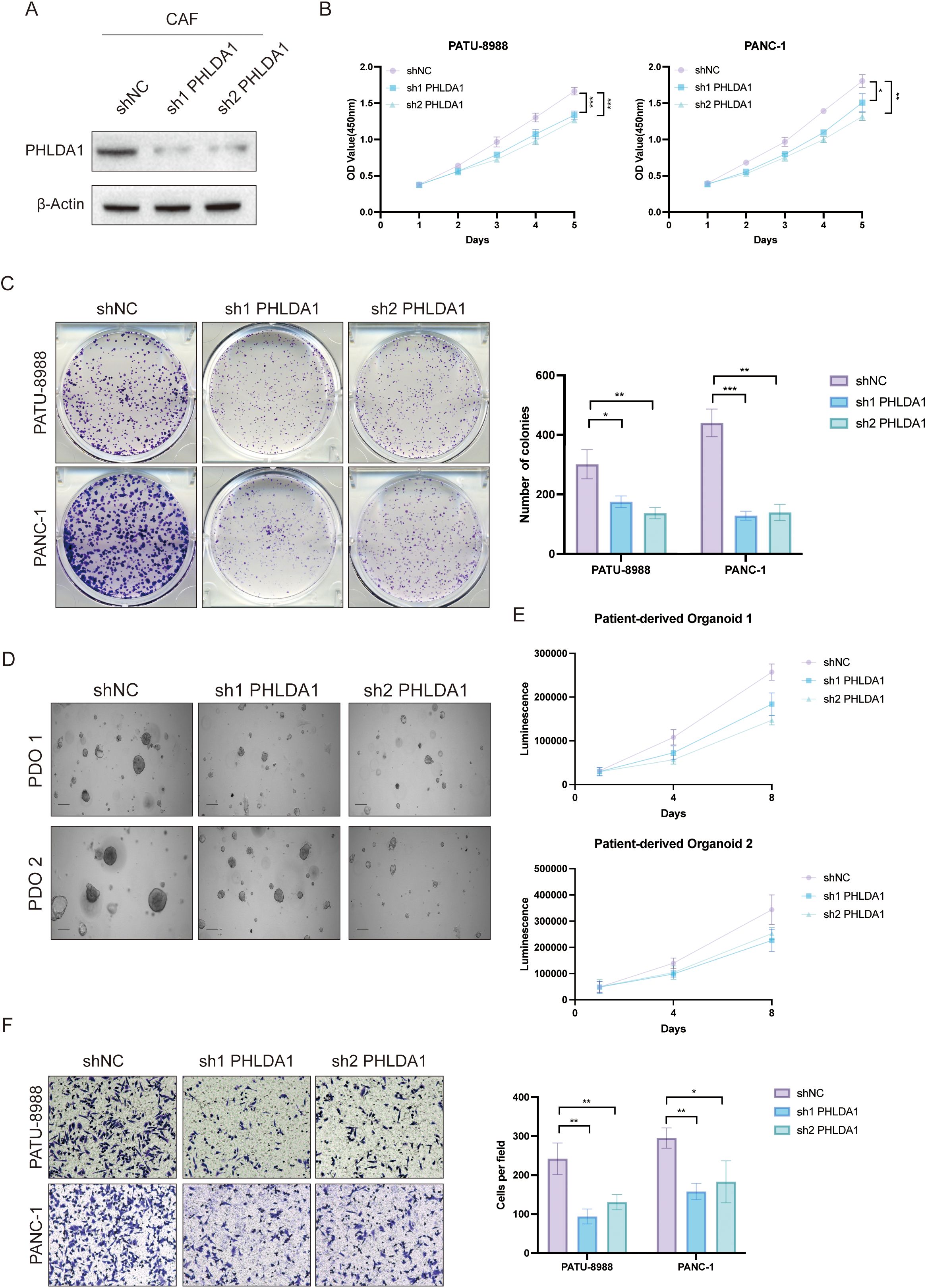 Western blot, colony formation, and organoid images evaluating PHLDA1 knockdown effects with shNC, sh1 PHLDA1, and sh2 PHLDA1. (A) Western blot shows PHLDA1 and β-Actin expression. (B) Line graphs show cell growth over 5 days for PATU-8988 and PANC-1. (C) Colony assays and bar graph illustrate reduced colonies in PHLDA1 knockdowns. (D) Organoid images show size differences in patient-derived organoids with reduced growth in knockdowns. (E) Line graphs depict luminescence trends in organoids over 8 days. (F) Migration assay images with bar graph show fewer cells per field in knockdowns, indicating decreased migration.