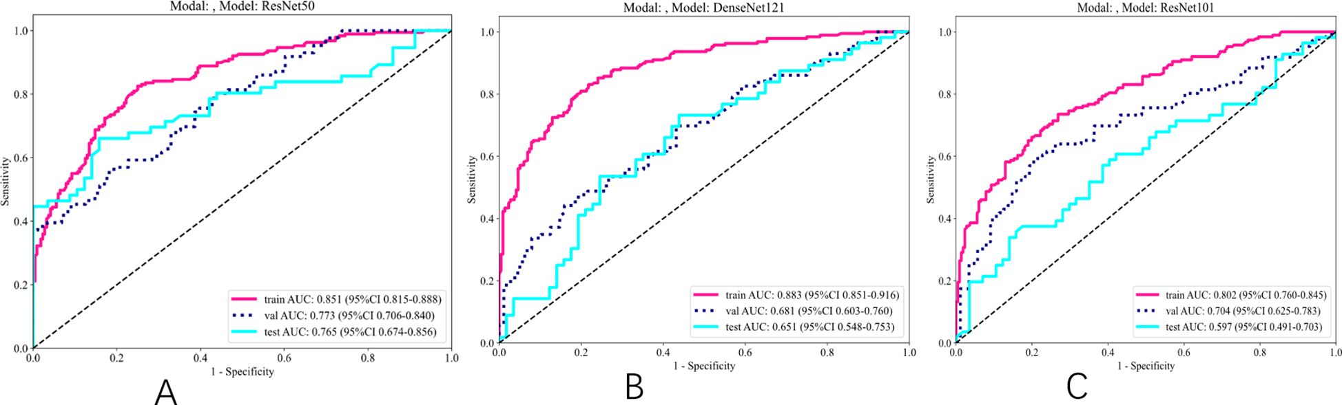 Three ROC curve plots labeled A, B, and C compare the performance of models: ResNet50, DenseNet121, and ResNet101. Each plot displays curves for training, validation, and test datasets with corresponding AUC values. The ResNet50 model shows a higher AUC across datasets compared to the other models. Dash lines represent chance levels.