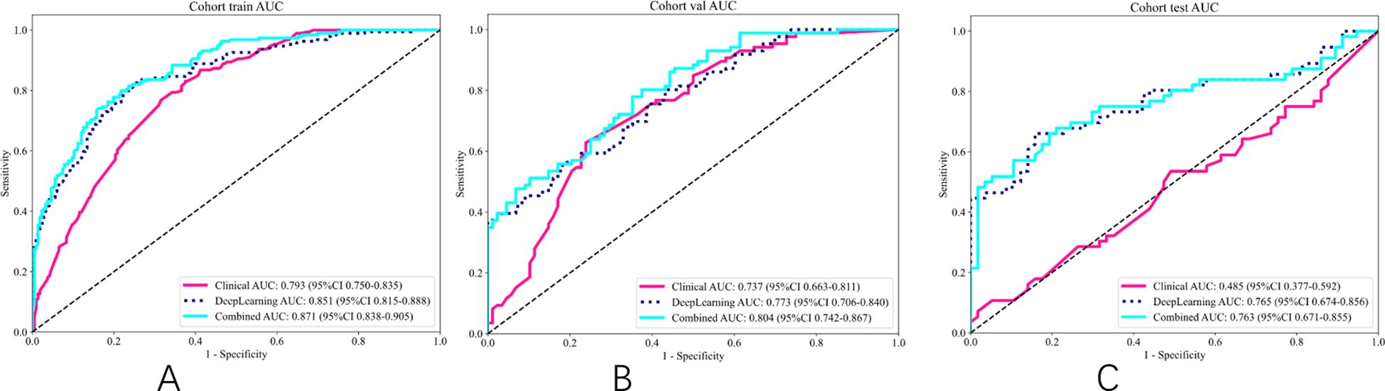 Three ROC curves compare model performance. Panel A: ResNet50, train AUC 0.851, val AUC 0.773, test AUC 0.765. Panel B: DenseNet121, train AUC 0.883, val AUC 0.681, test AUC 0.651. Panel C: ResNet101, train AUC 0.802, val AUC 0.704, test AUC 0.597. Each curve shows sensitivity against one minus specificity.