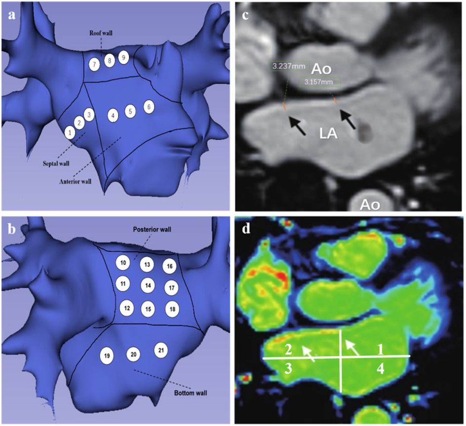 Panel (a) and (b) are 3D models showing the interior walls of a heart section labeled with numbered regions. Panel (c) is a grayscale scan displaying the heart’s left atrium (LA) and aorta (Ao) with measurements. Panel (d) is a color-coded scan illustrating metabolic activity with labeled quadrants.