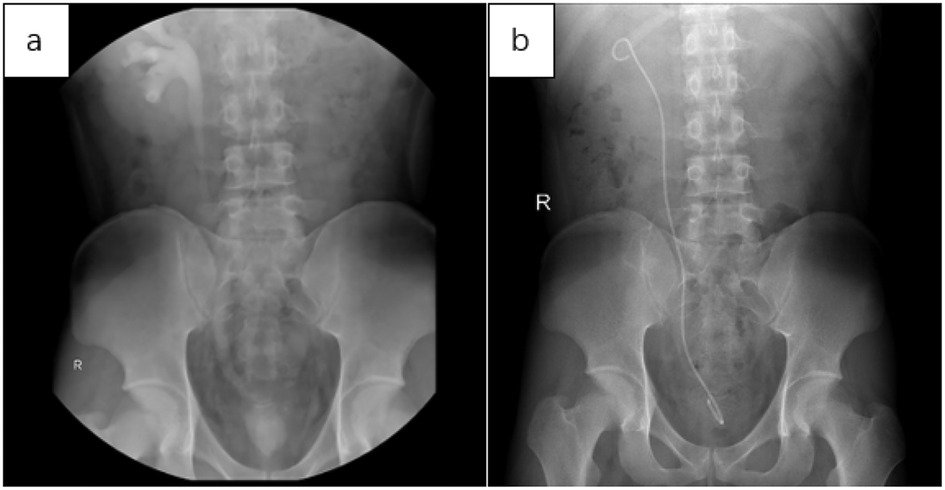 Two X-ray images labeled \