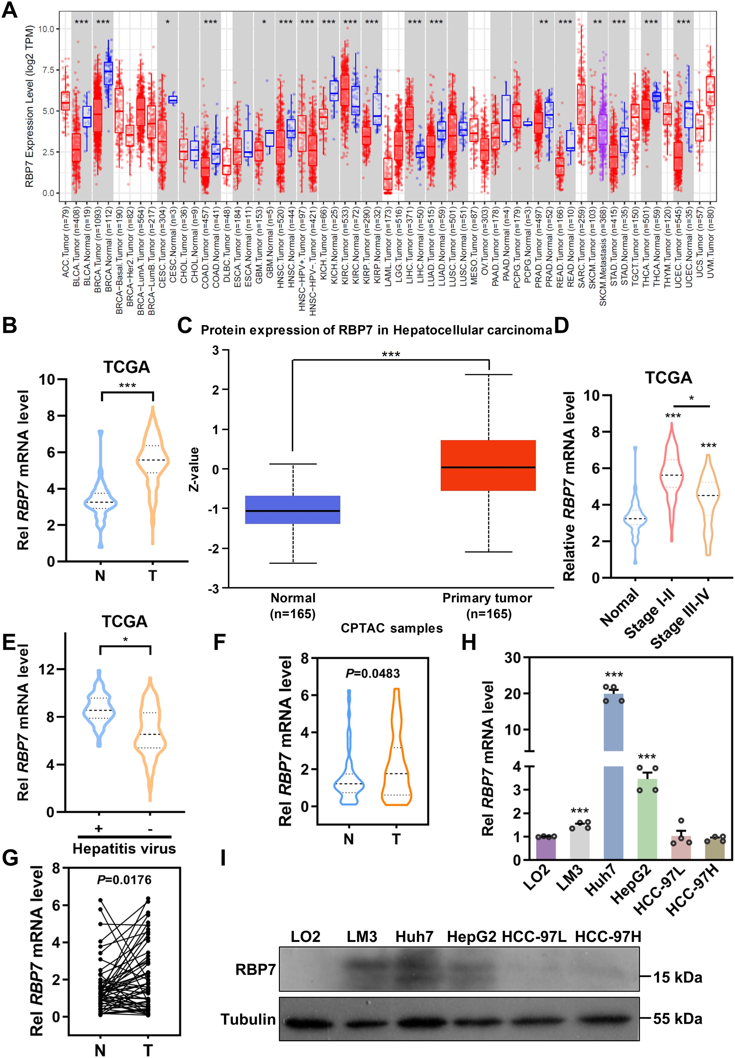 Graphical representation of RBP7 expression patterns: A. Boxplots of RBP7 expression in various cancers and normal tissues. B. Violin plot comparing RBP7 mRNA levels in normal (N) and tumor (T) tissues from TCGA. C. Boxplots showing protein expression of RBP7 in hepatocellular carcinoma, contrasting normal with primary tumors. D. Violin plot of RBP7 mRNA levels across different cancer stages. E. Violin plot indicating RBP7 mRNA levels relative to hepatitis virus presence. F. Violin plot of RBP7 levels in normal and tumor tissues. G. Scatter plot comparing RBP7 levels between normal and tumor samples. H. Bar graph of RBP7 mRNA levels in various cell lines. I. Western blot analysis showing RBP7 protein bands, with tubulin as a control. Statistical significance indicated by asterisks.