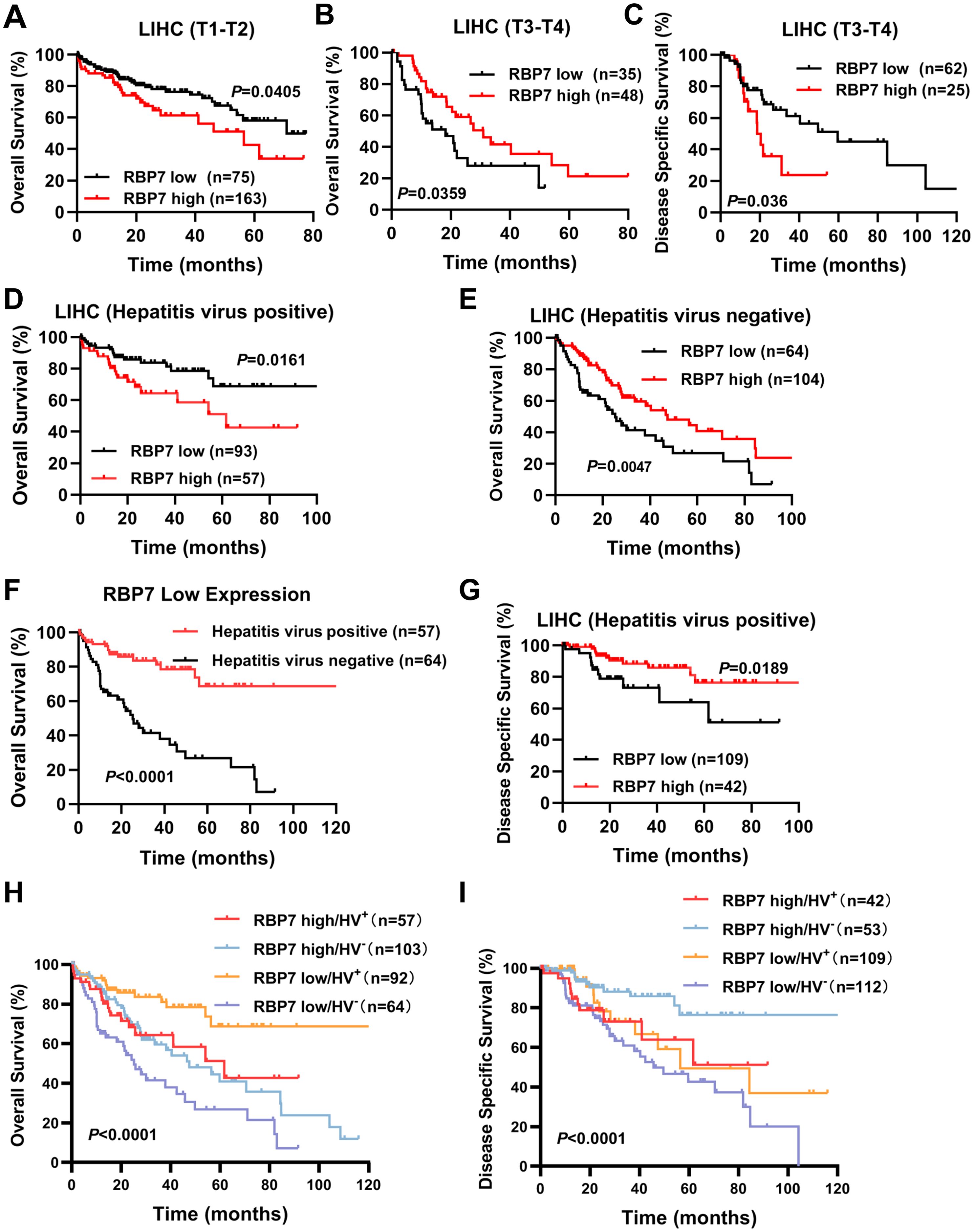Kaplan-Meier survival curves analyzing the impact of RBP7 expression on liver hepatocellular carcinoma (LIHC) survival. Panels A-E show overall survival based on tumor stage and hepatitis virus status, with RBP7 high expression associated with improved survival. Panels F-I illustrate overall and disease-specific survival comparing RBP7 expression in hepatitis virus positive and negative groups. Each panel includes key statistics such as p-values, indicating significant differences in survival rates.