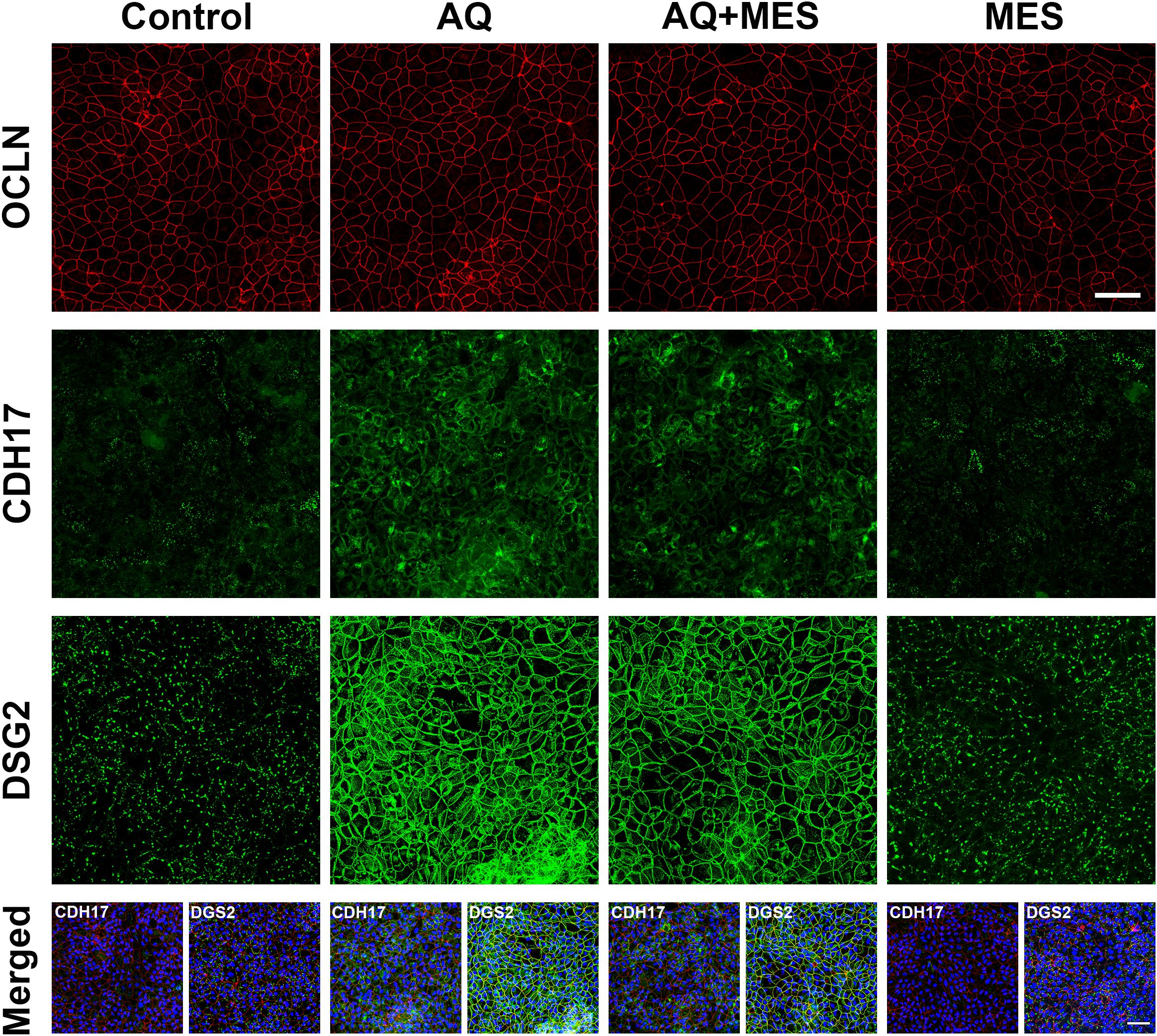 Fluorescent microscopy images showing expression of proteins OCLN, CDH17, and DSG2 in four different conditions: Control, Aquamin, AQ+Mesalamine, Mesalamine. OCLN appears in red, while CDH17 and DSG2 are green. The merged row displays combined channels with blue nuclei staining. Each condition shows variations in protein expression patterns across the rows.<