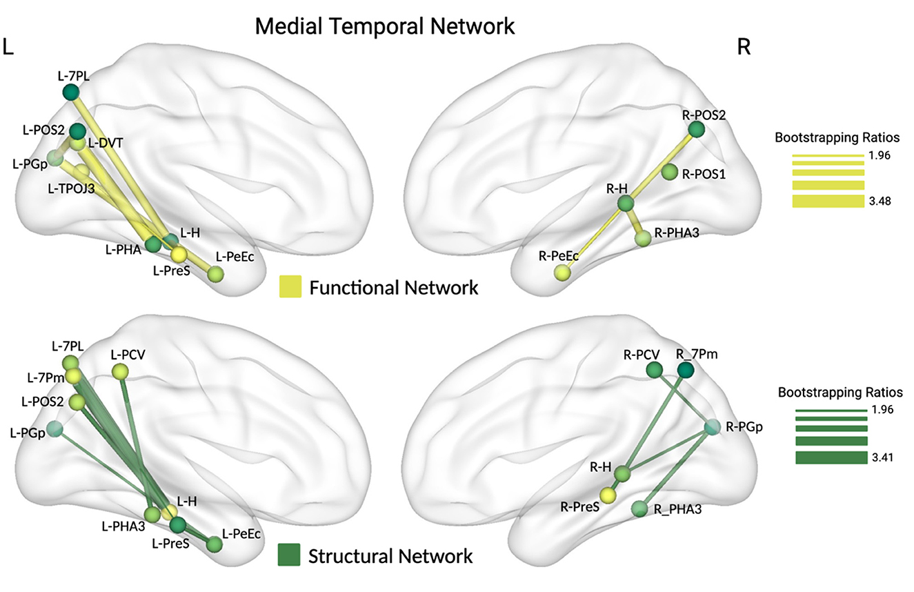 Medial Temporal Network diagram showing functional and structural connections in the brain. The top half represents functional networks with yellow pathways, and the bottom half shows structural networks with green pathways. Each section includes labeled brain regions with bootstrapping ratios indicated by color intensity. Each pathway corresponds to different lateralized sections of the brain, marked as L (left) and R (right). A key indicates bootstrapping ratios ranging from 1.96 to 3.48 for functional and 1.96 to 3.41 for structural connections.