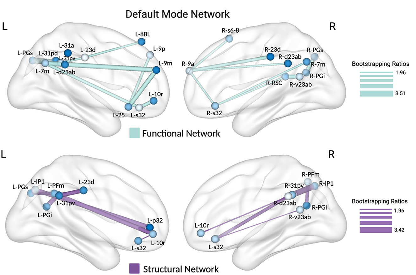 Functional and structural networks of the Default Mode Network in the brain are illustrated with labeled nodes on brain outlines. Top shows functional connections in teal, bottom shows structural connections in purple. Bootstrapping ratio scales are included for both.