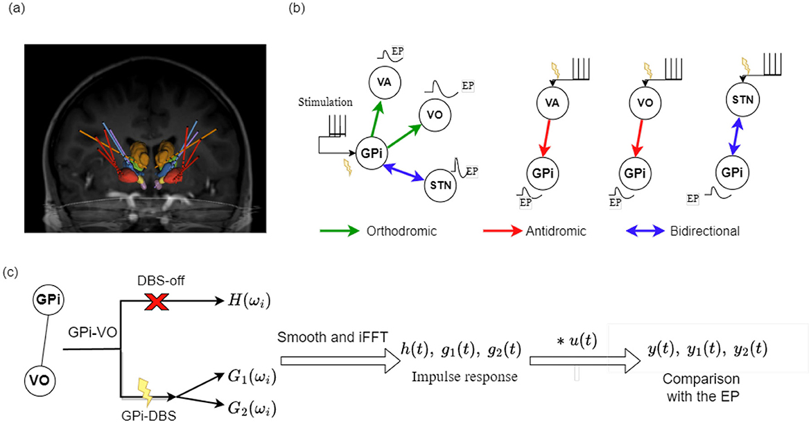 MRI scan shows deep brain structures with highlighted pathways. Diagram (b) illustrates connections–orthodromic (green), antidromic (red), and bidirectional (blue)–between GPi, VA, VO, and STN with stimulation points. Diagram (c) pipeline of transfer functions computations and comparisons for one pathway connecting the GPi and VoaVop (VO) electrodes.
