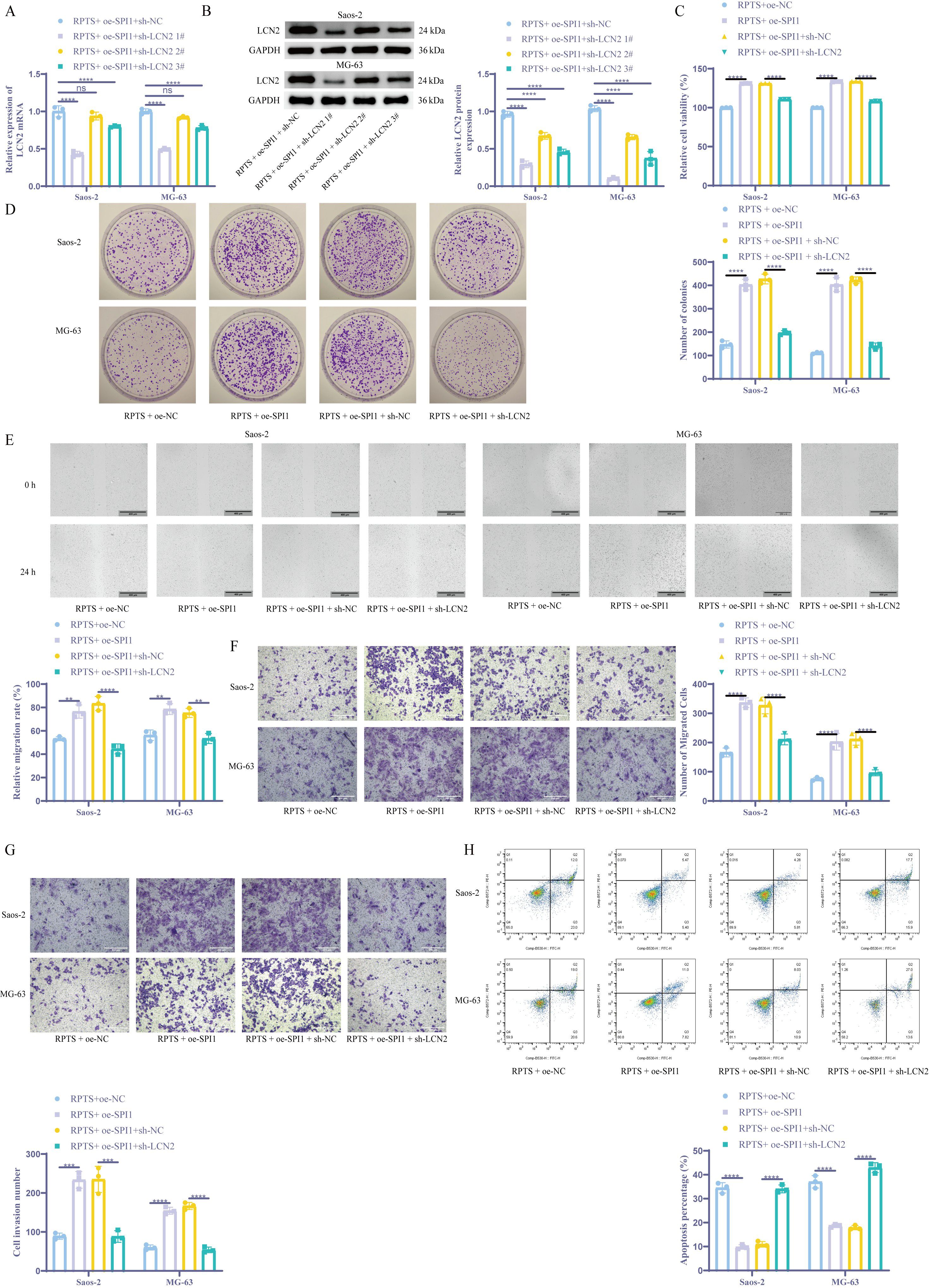 Graphs and images depict gene expression and cell behavior in Saos-2 and MG-63 cell lines with different treatments. Charts display cell viability, colony formation, migration, invasion, and apoptosis rates, alongside corresponding microscopic images and western blot analysis. Experimental conditions include RPTS with various gene modulations, highlighting differences in cellular responses.