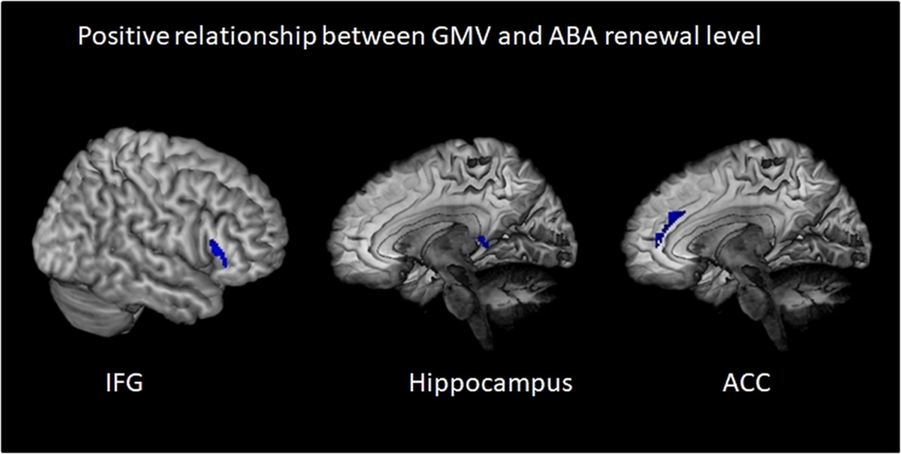 Three brain scans illustrate a positive relationship between gray matter volume and ABA renewal level. Regions highlighted in blue are the inferior frontal gyrus (IFG), hippocampus, and anterior cingulate cortex (ACC).
