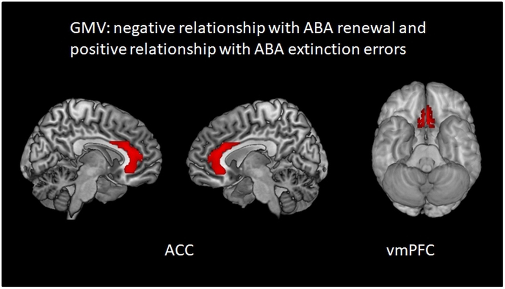 MRI brain scans showing areas in red. The first two images highlight the anterior cingulate cortex (ACC), and the third shows the ventromedial prefrontal cortex (vmPFC). Text mentions a negative relationship with ABA renewal and a positive relationship with ABA extinction errors.