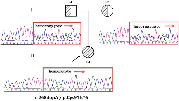 Pedigree diagram with genetic sequencing data. It shows three electropherograms highlighting heterozygote and homozygote sequences for individuals I-1, I-2, and II-1. Arrows point to specific variants, with labels indicating heterozygote in parents and homozygote in the child. Notation c.268dupA/p.Cys91fs*6 is shown.
