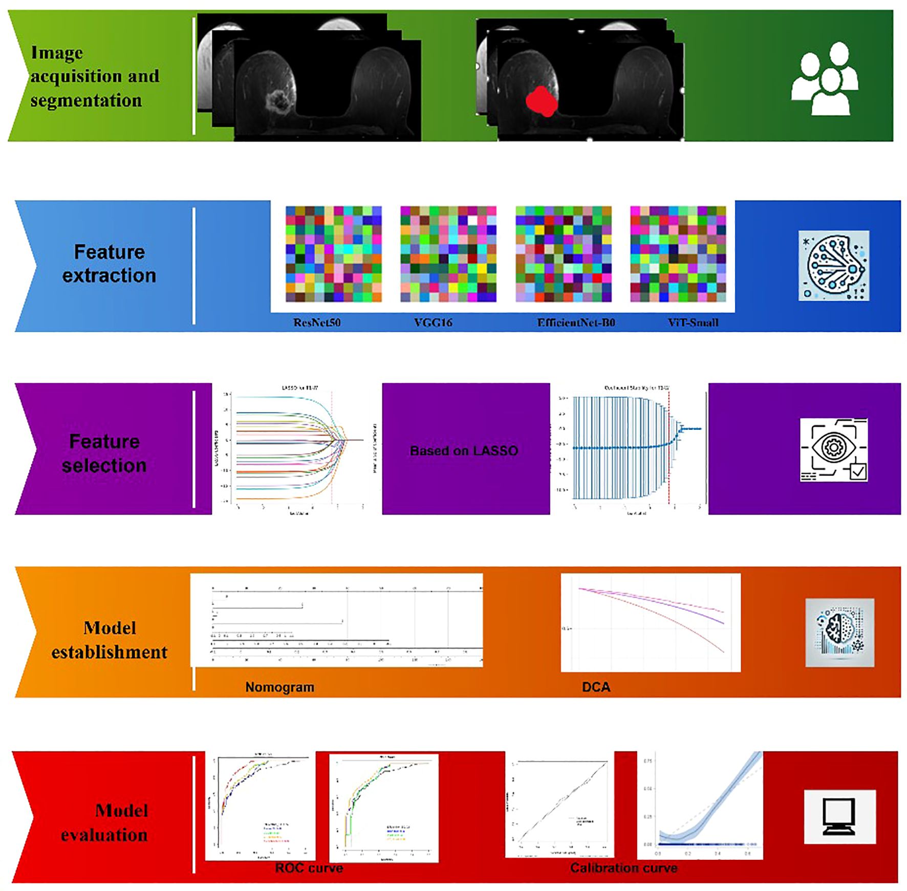 Flowchart illustrating a medical imaging process. It includes four stages: “Image Acquisition and Segmentation” with MRI scans; “Feature Extraction” using models like ResNet50, VGG16, EfficientNet-B0, and VIT-Small, represented by colorful grids; “Feature Selection” using LASSO, shown with charts; “Model Establishment” using a nomogram and DCA; and “Model Evaluation” with ROC and Calibration curves. Each stage is color-coded and uses graphical icons.