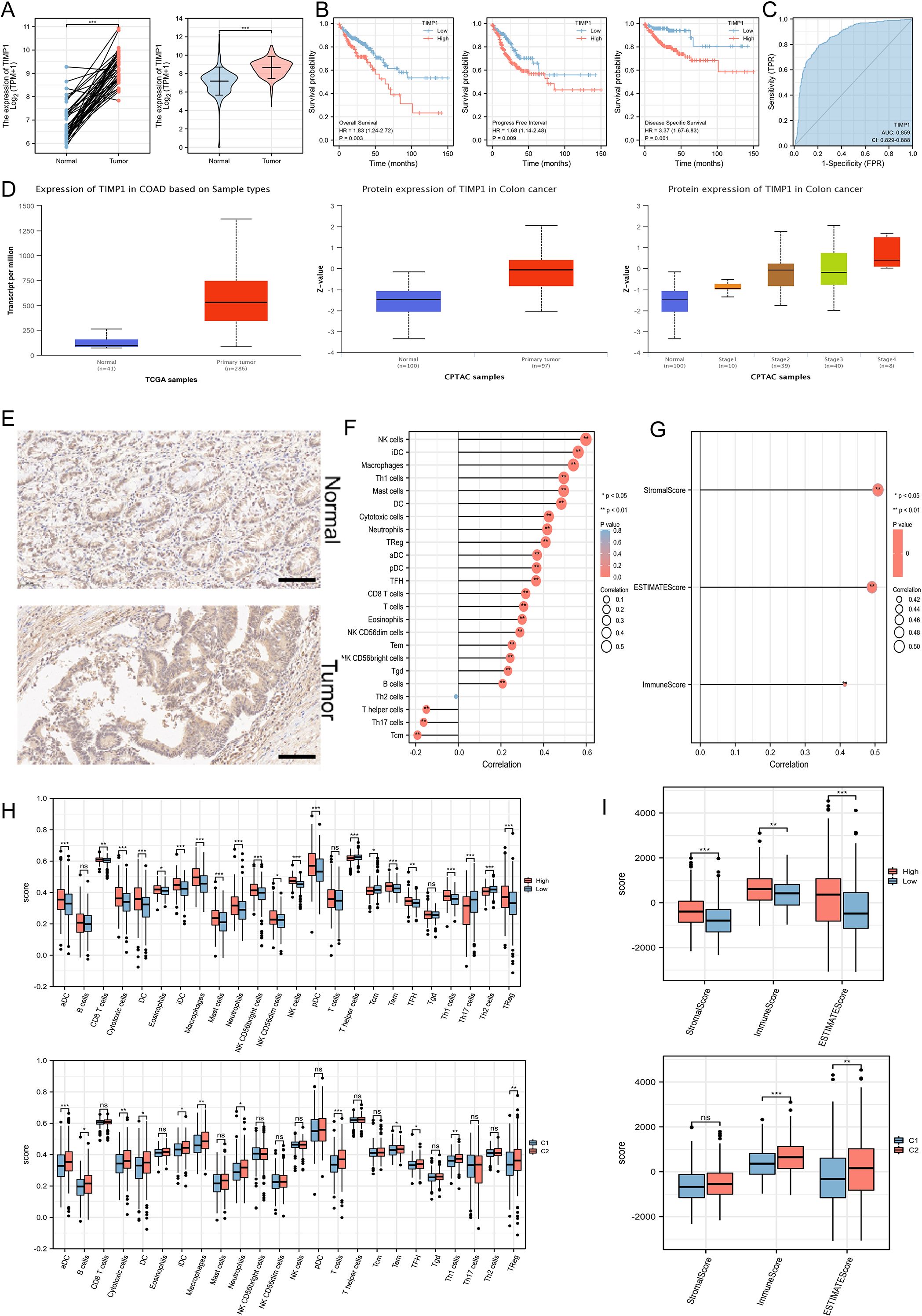 A series of scientific charts and graphs analyzing TIMP1 expression in colorectal cancer. Panel A shows expression differences in normal versus tumor tissues with paired and violin plots. Panel B presents survival analysis with Kaplan-Meier plots. Panel C includes a ROC curve. Panel D compares TIMP1 levels in various samples with box plots. Panel E provides histology images of normal and tumor tissues. Panel F and G display correlation analyses with bubble plots. Panel H contains box plots for different immune cell types. Panel I shows box plots of scores such as Stromal and Immune scores in different conditions.